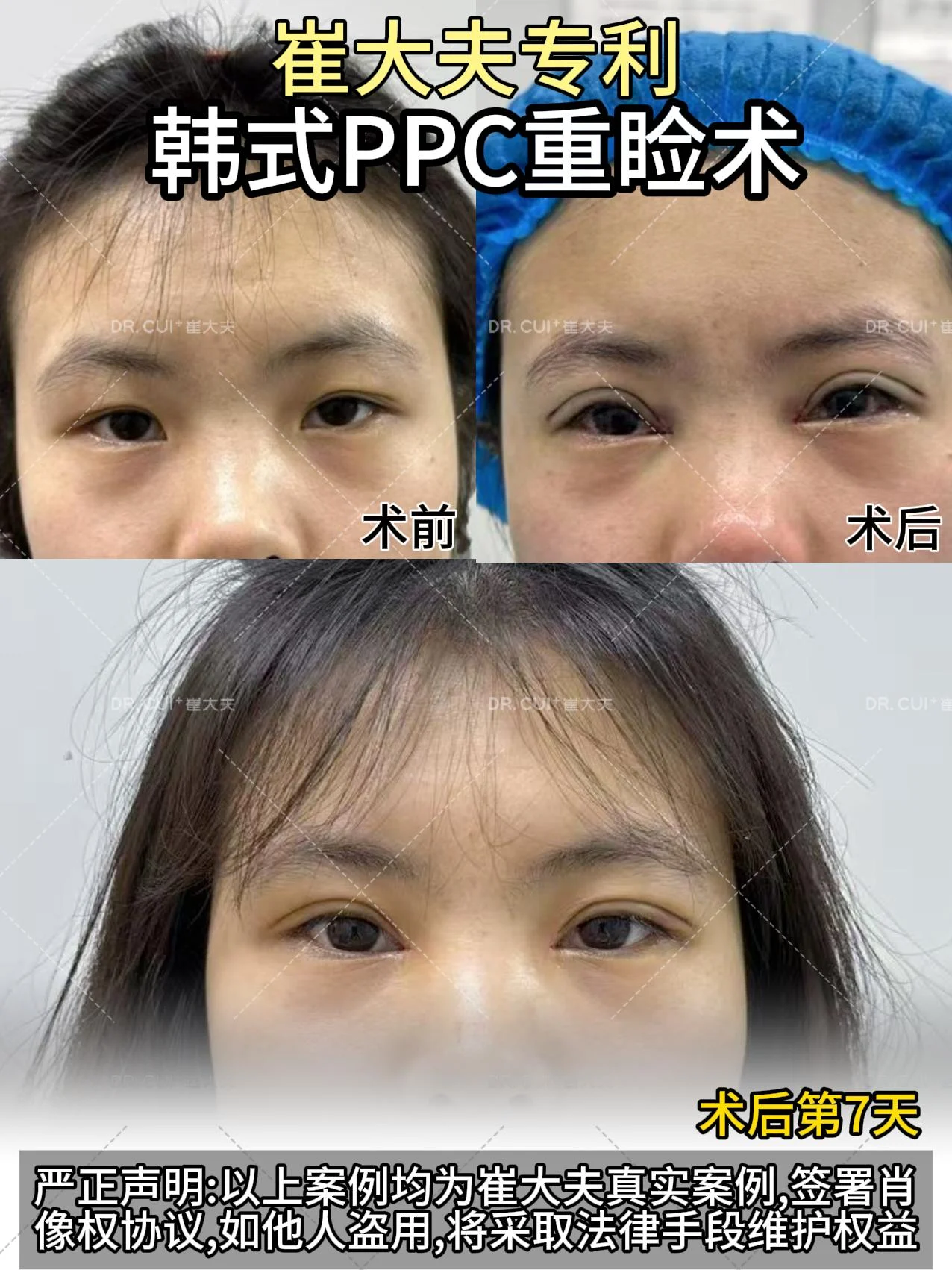 对比 (35)