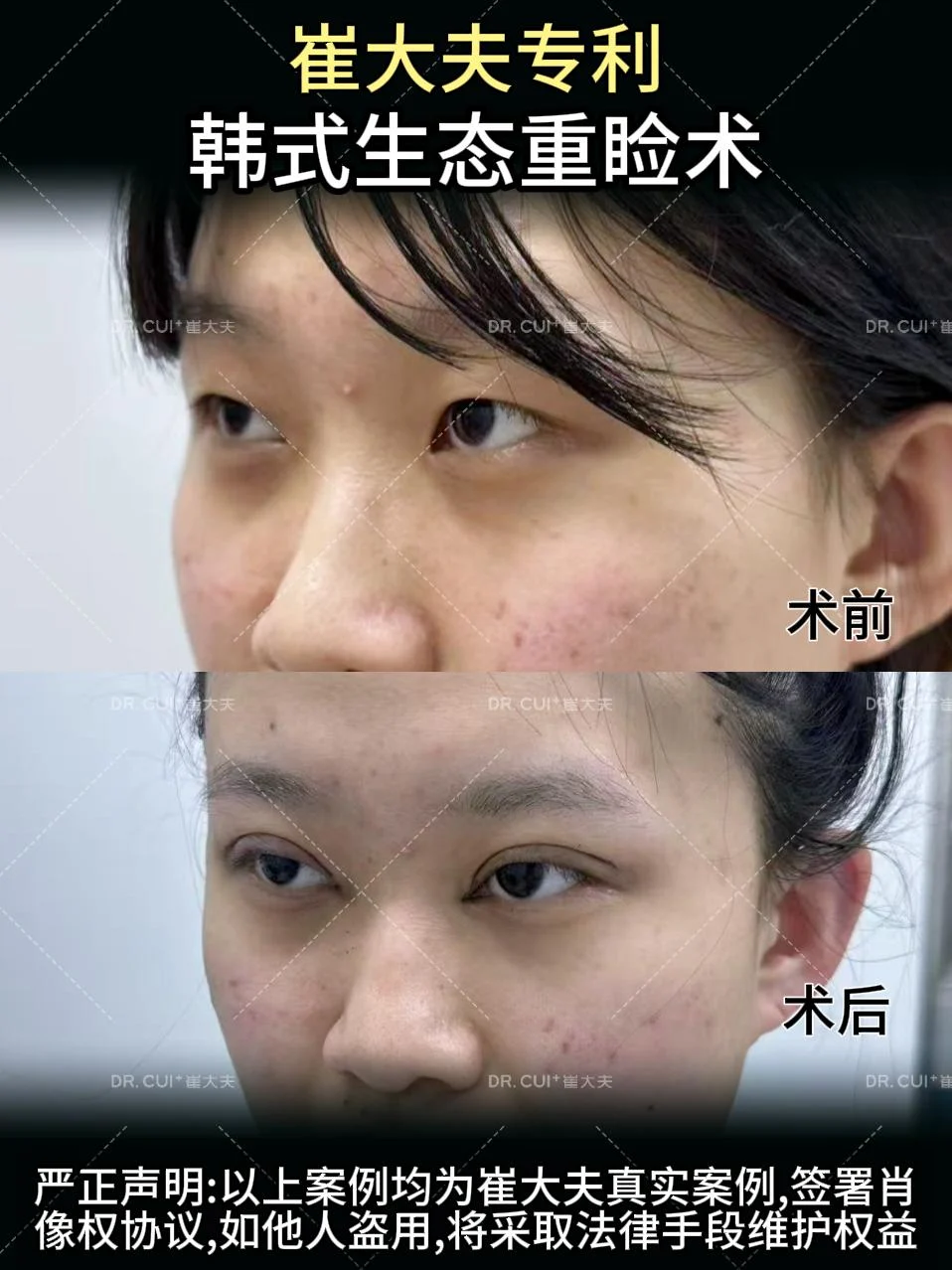 对比 (41)