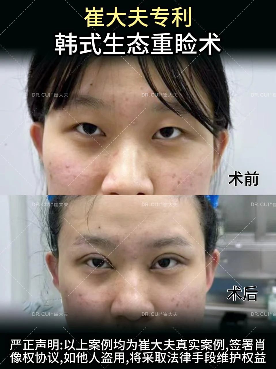 对比 (40)