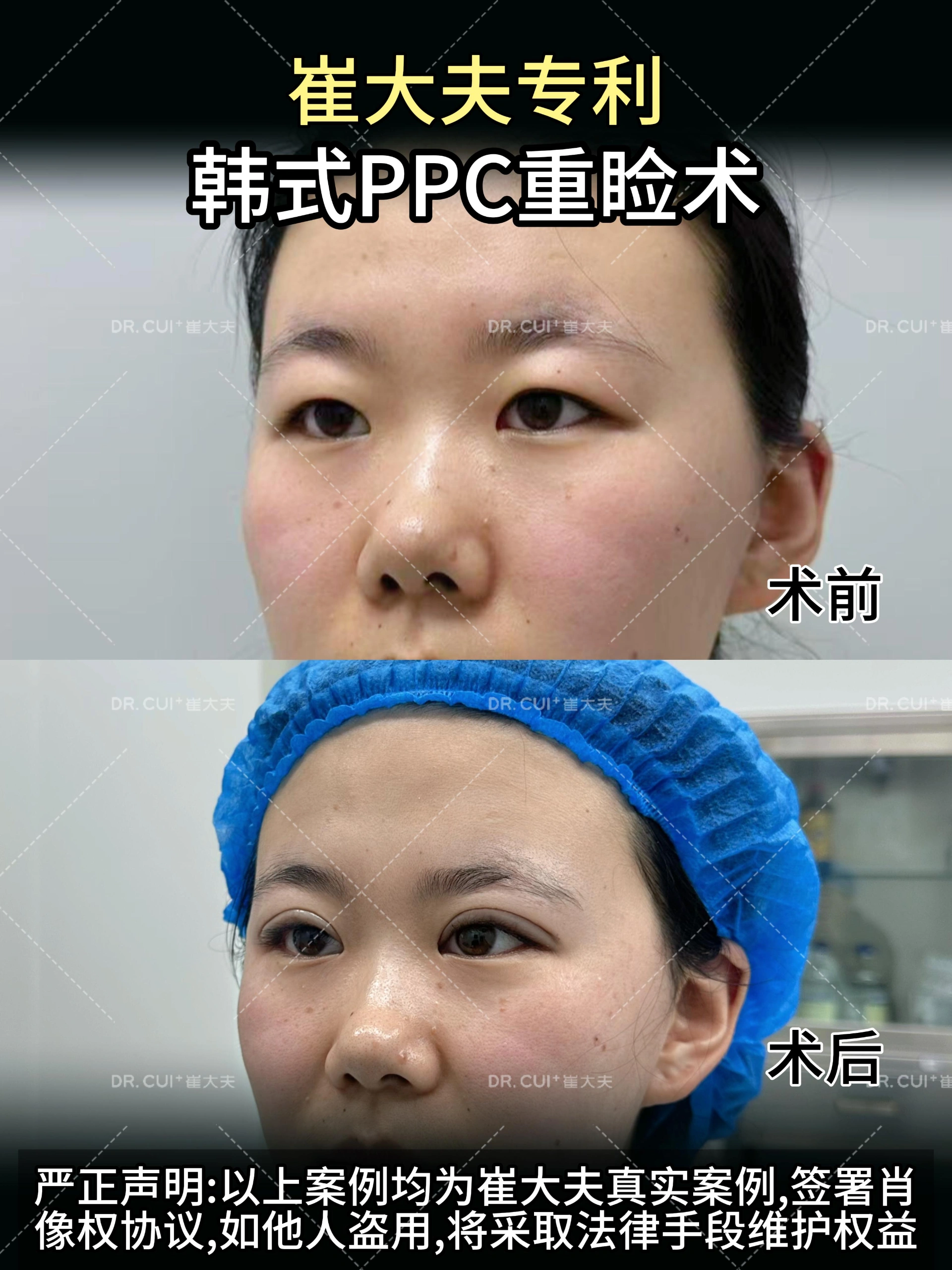 对比 (43)