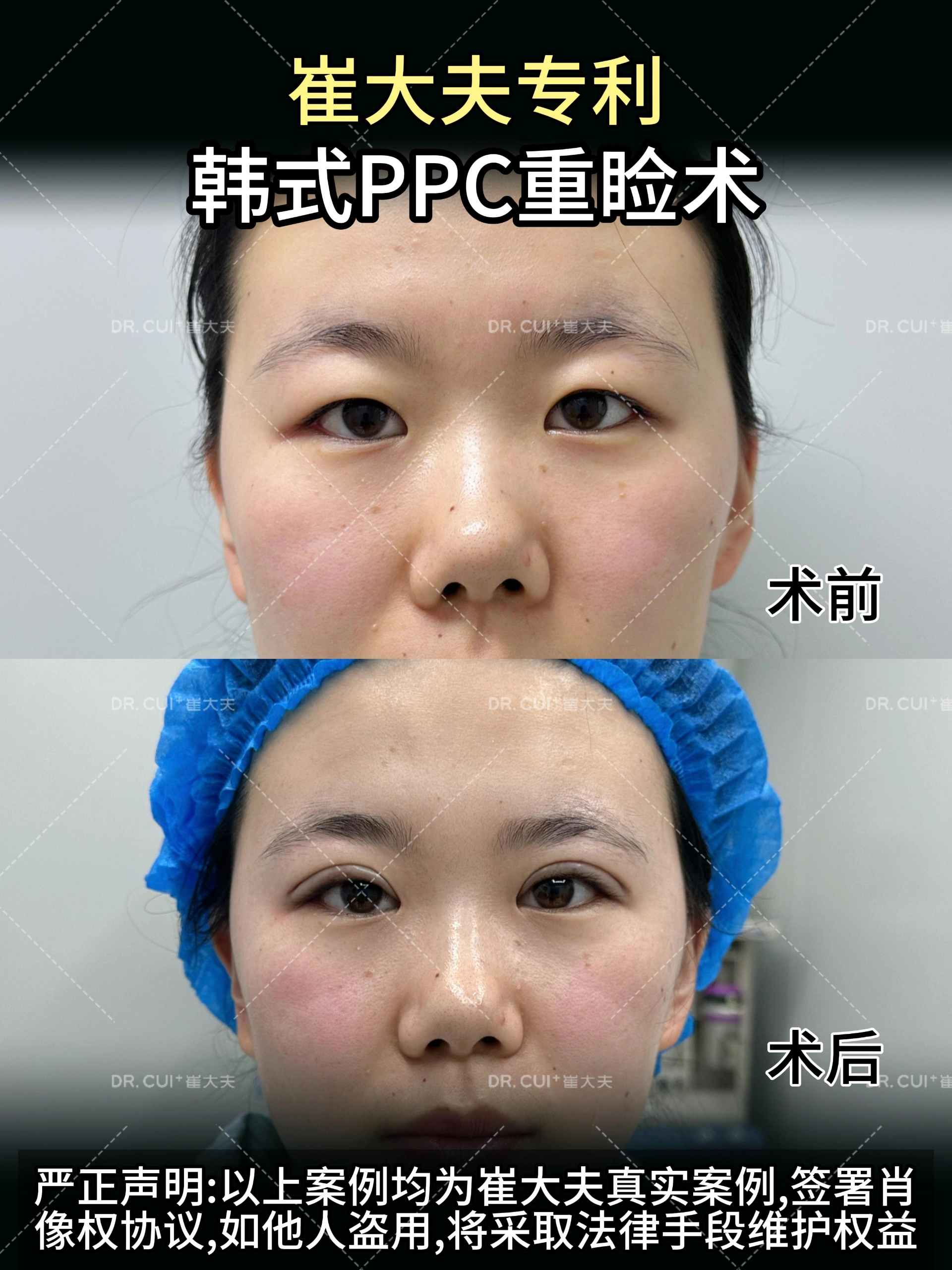 对比 (44)