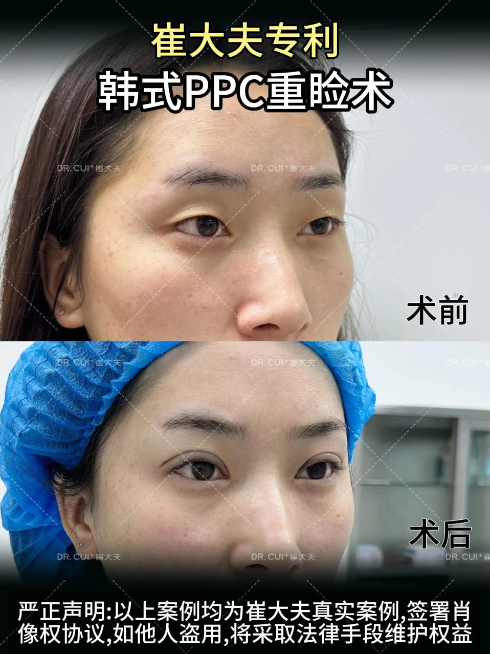 对比 (45)
