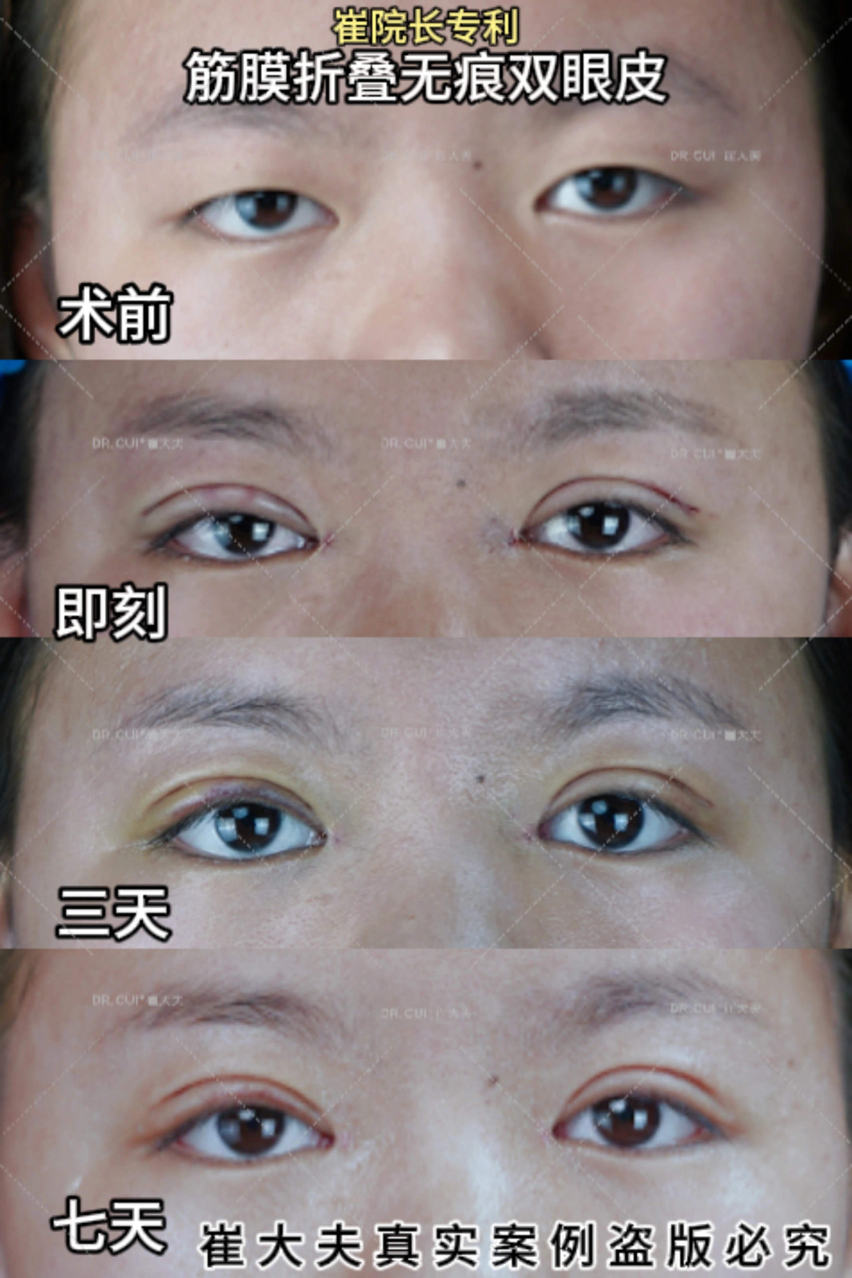 对比 (49)