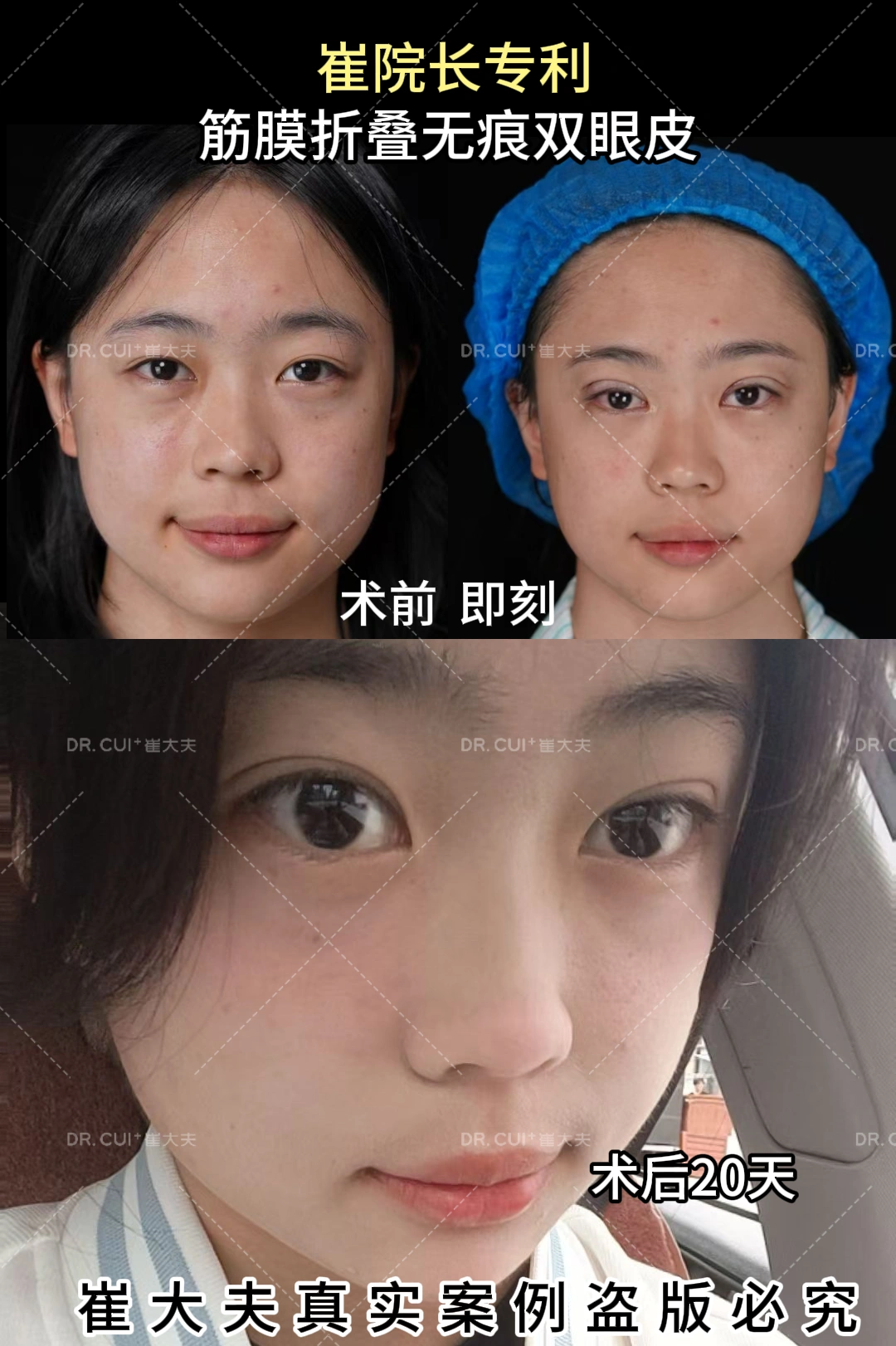 对比 (55)