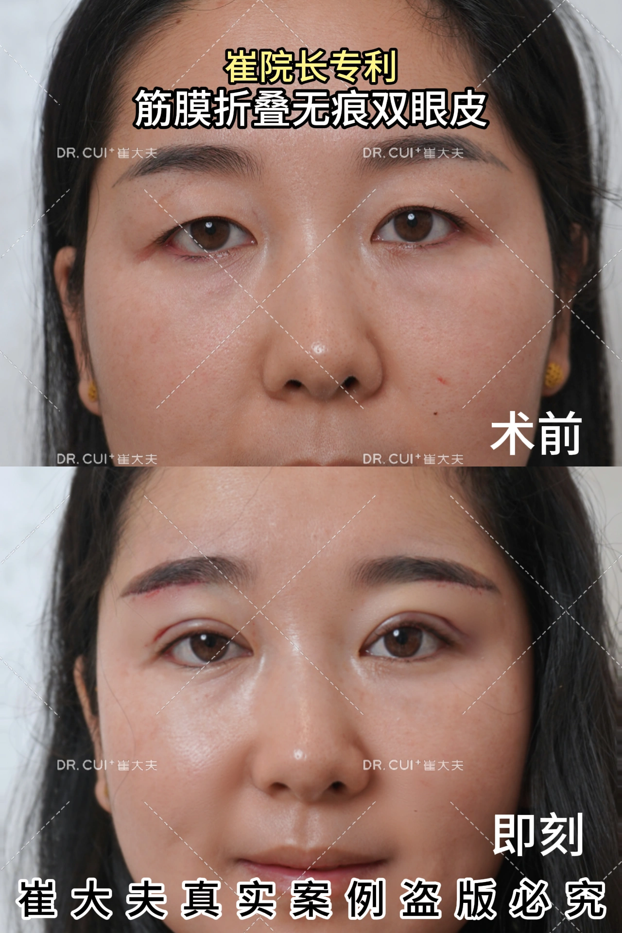 对比 (56)