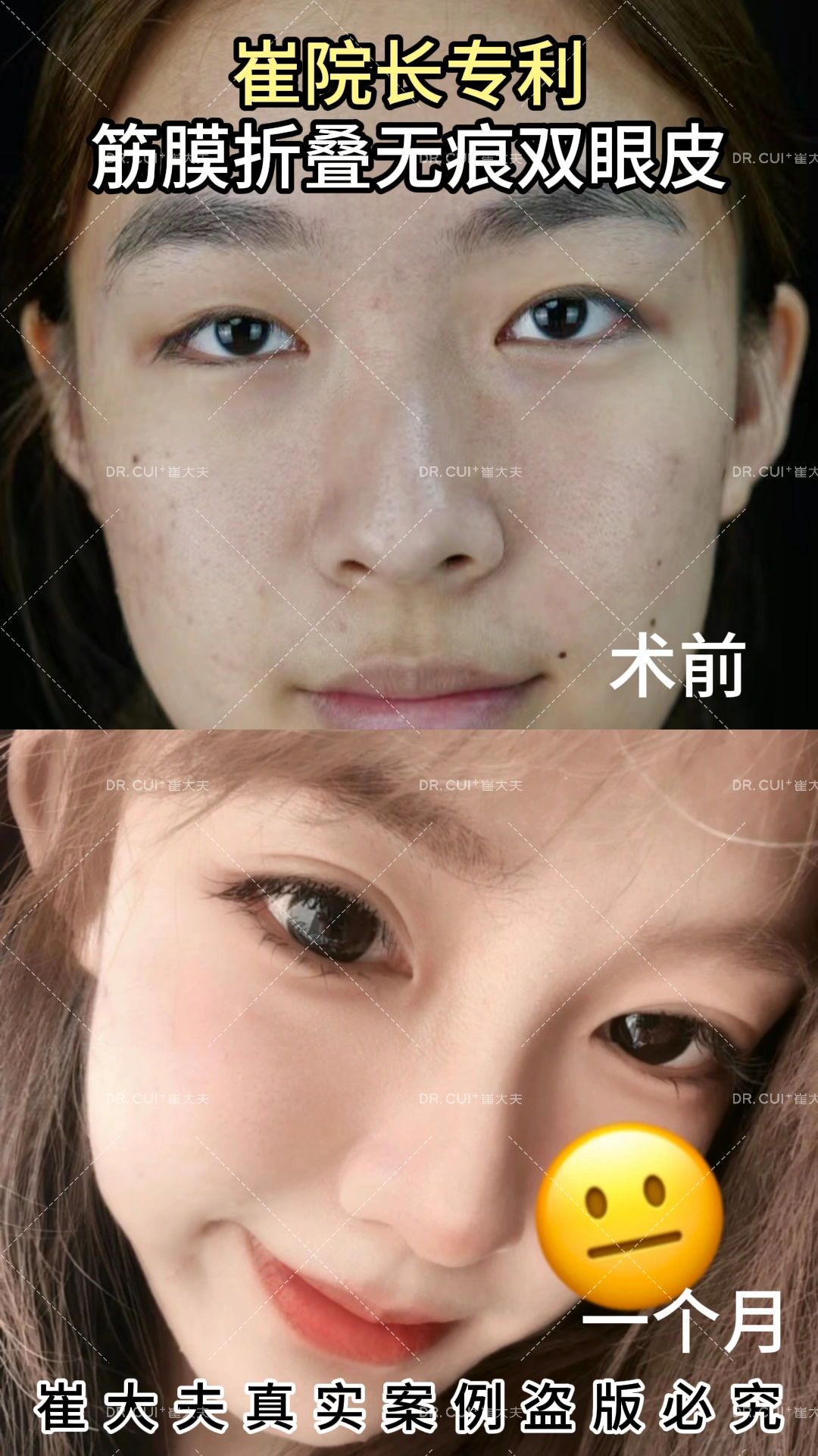 对比 (58)