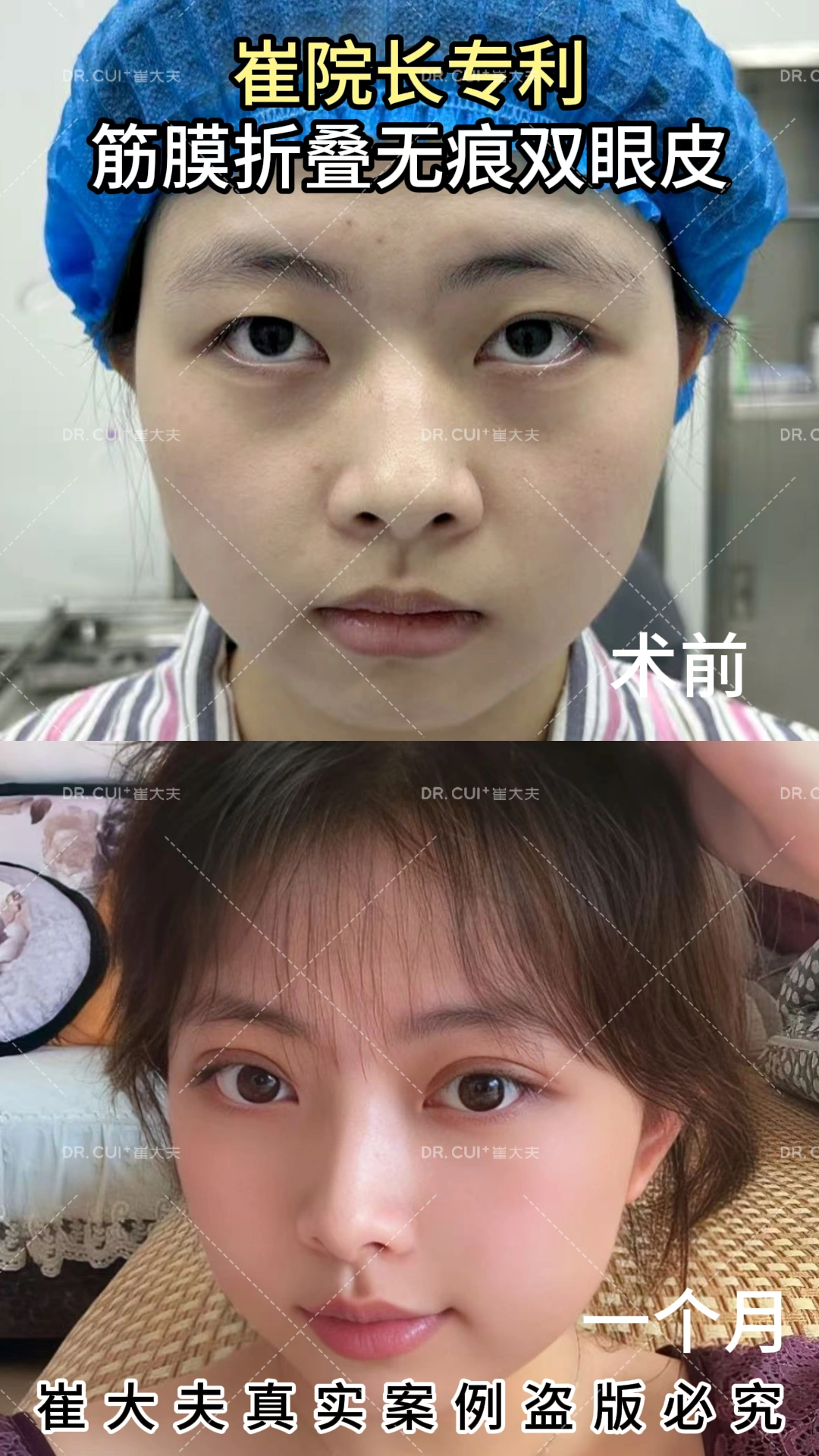 对比 (59)