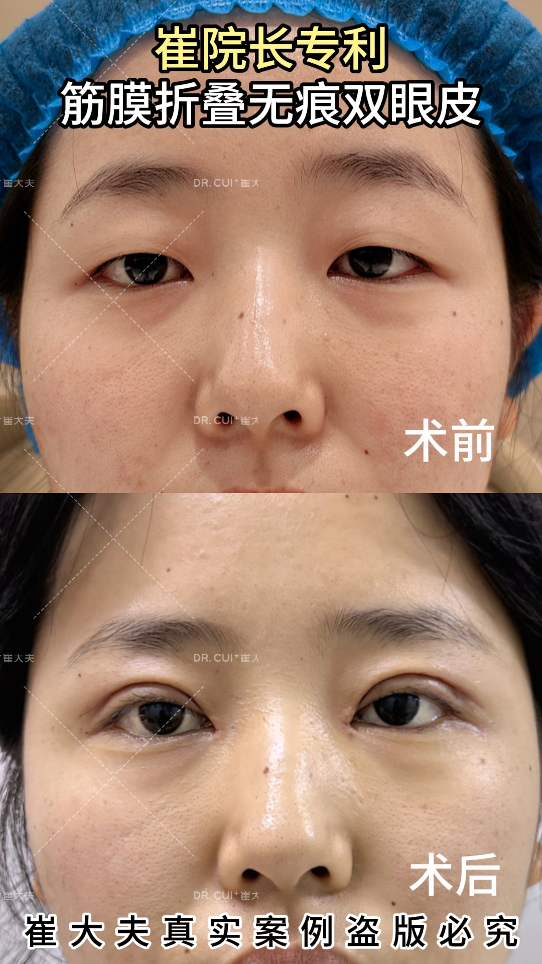 对比 (60)