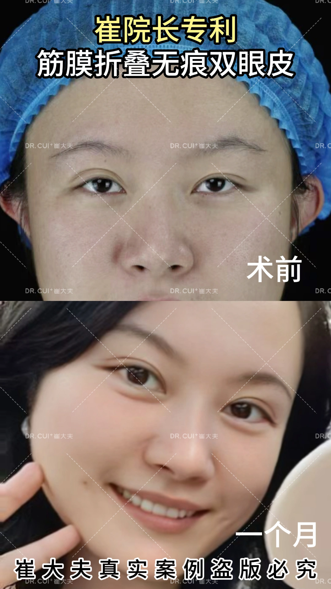 对比 (61)