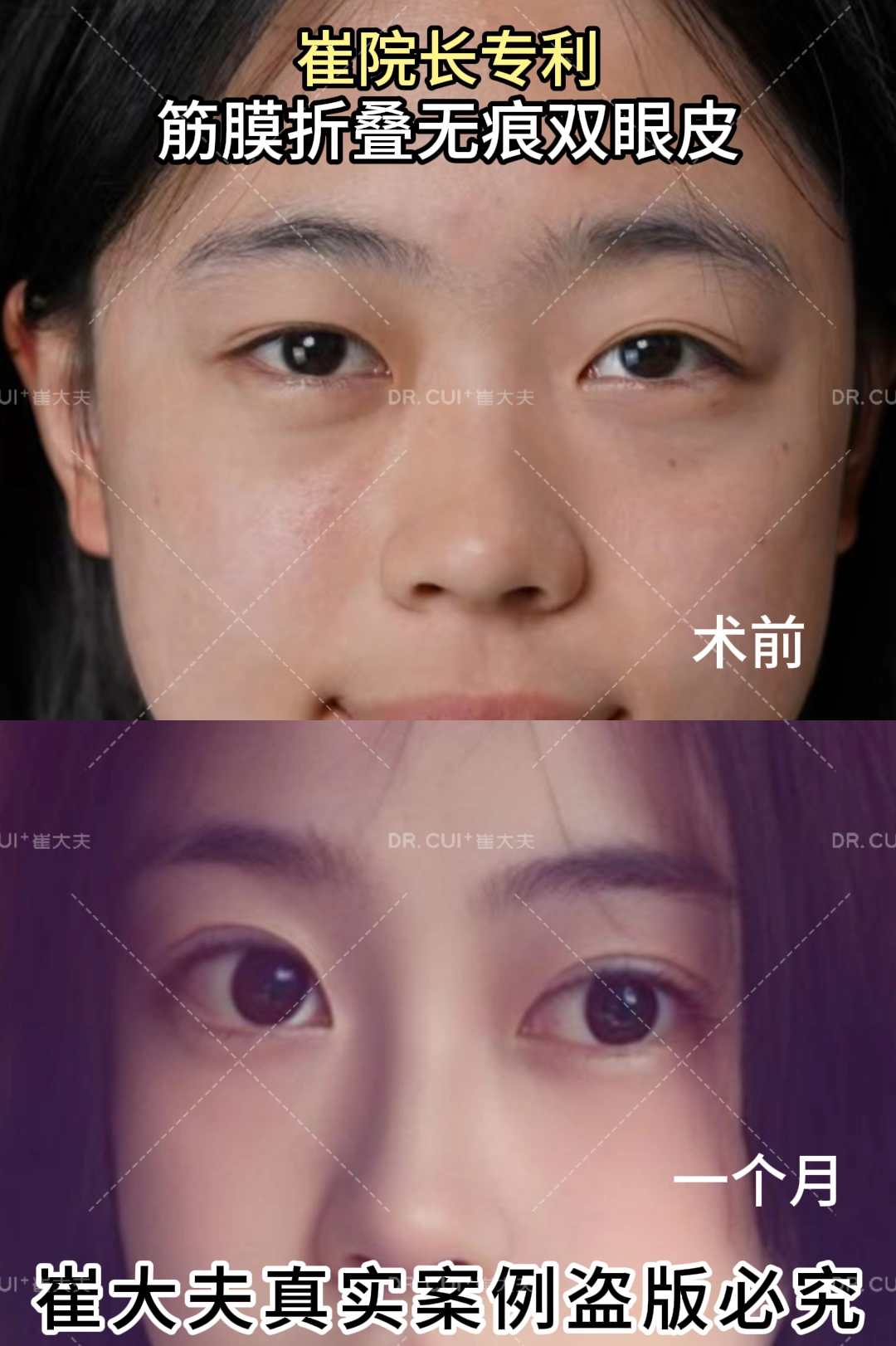 对比 (63)