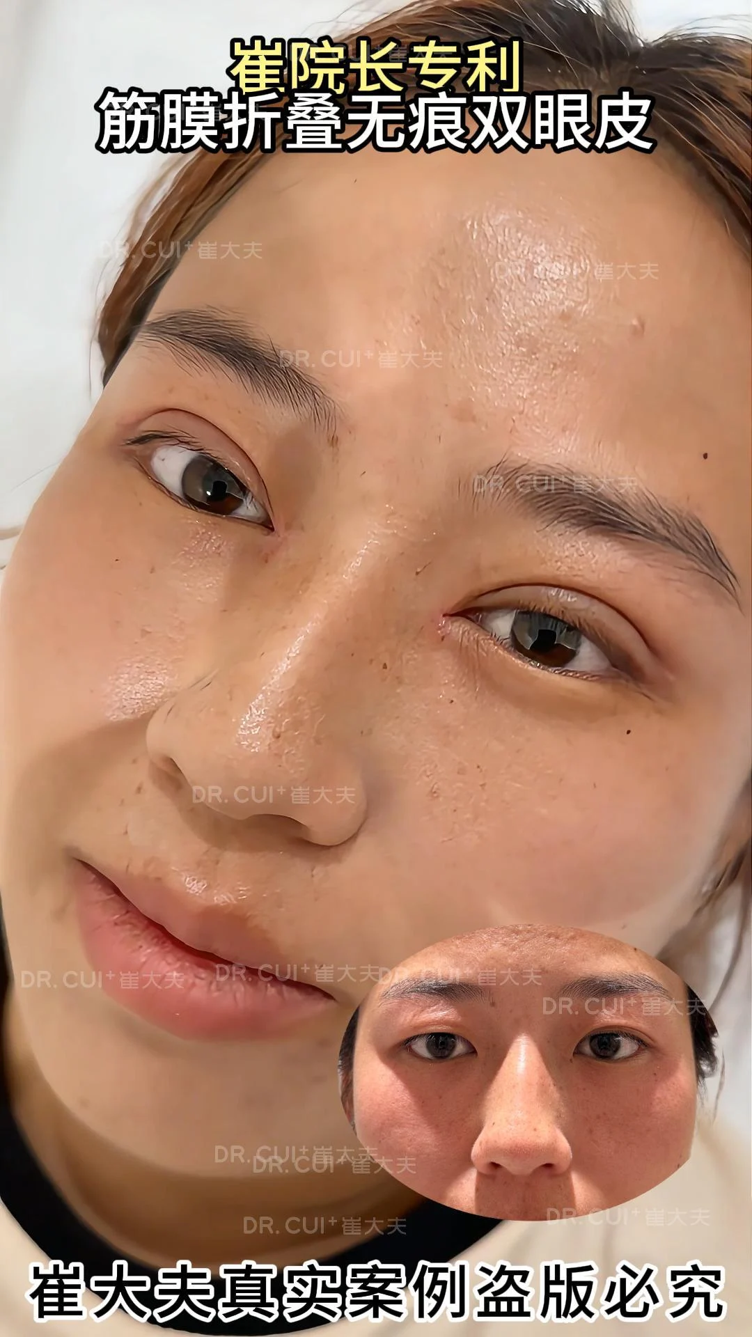 对比 (66)