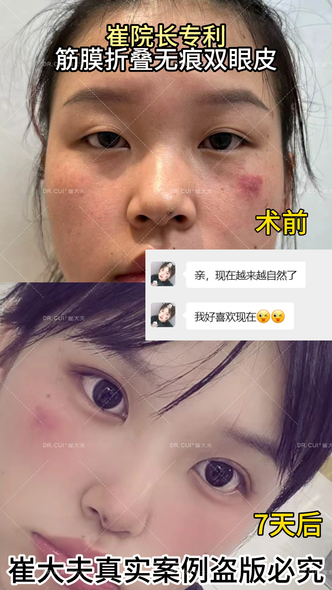 对比 (69)