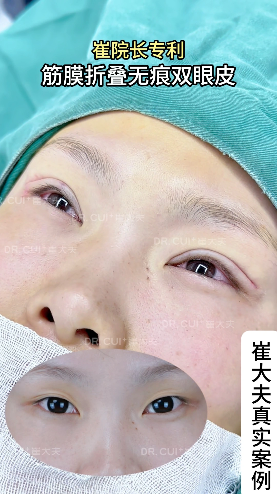 对比 (70)