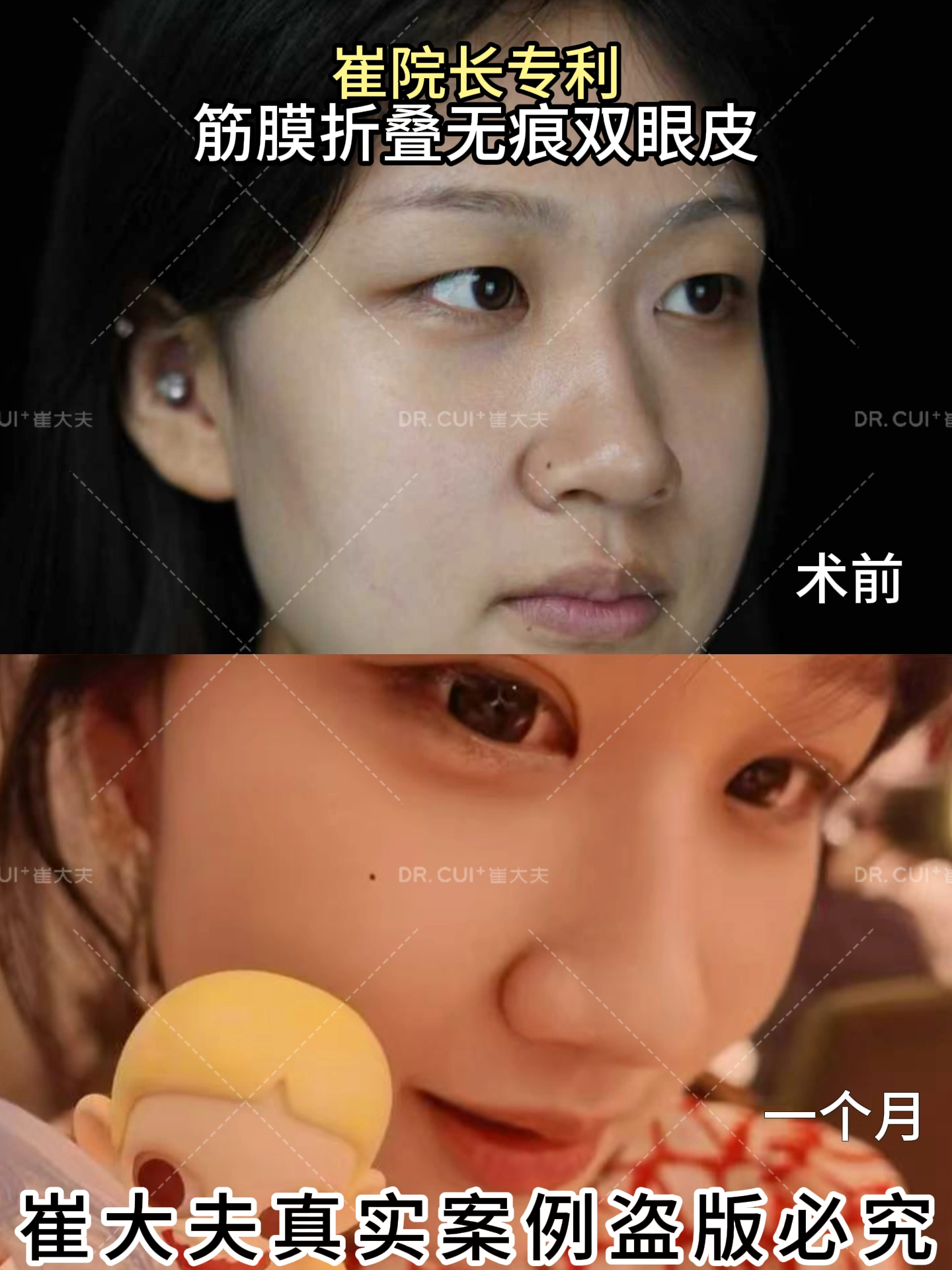 对比 (72)