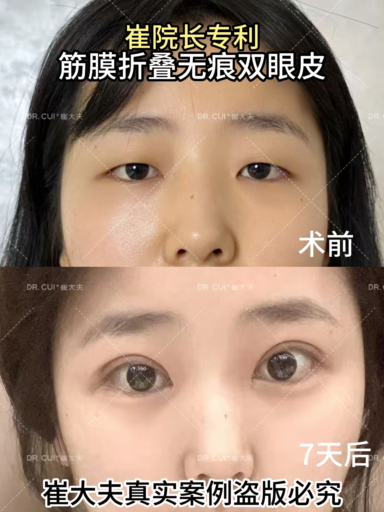 对比 (71)