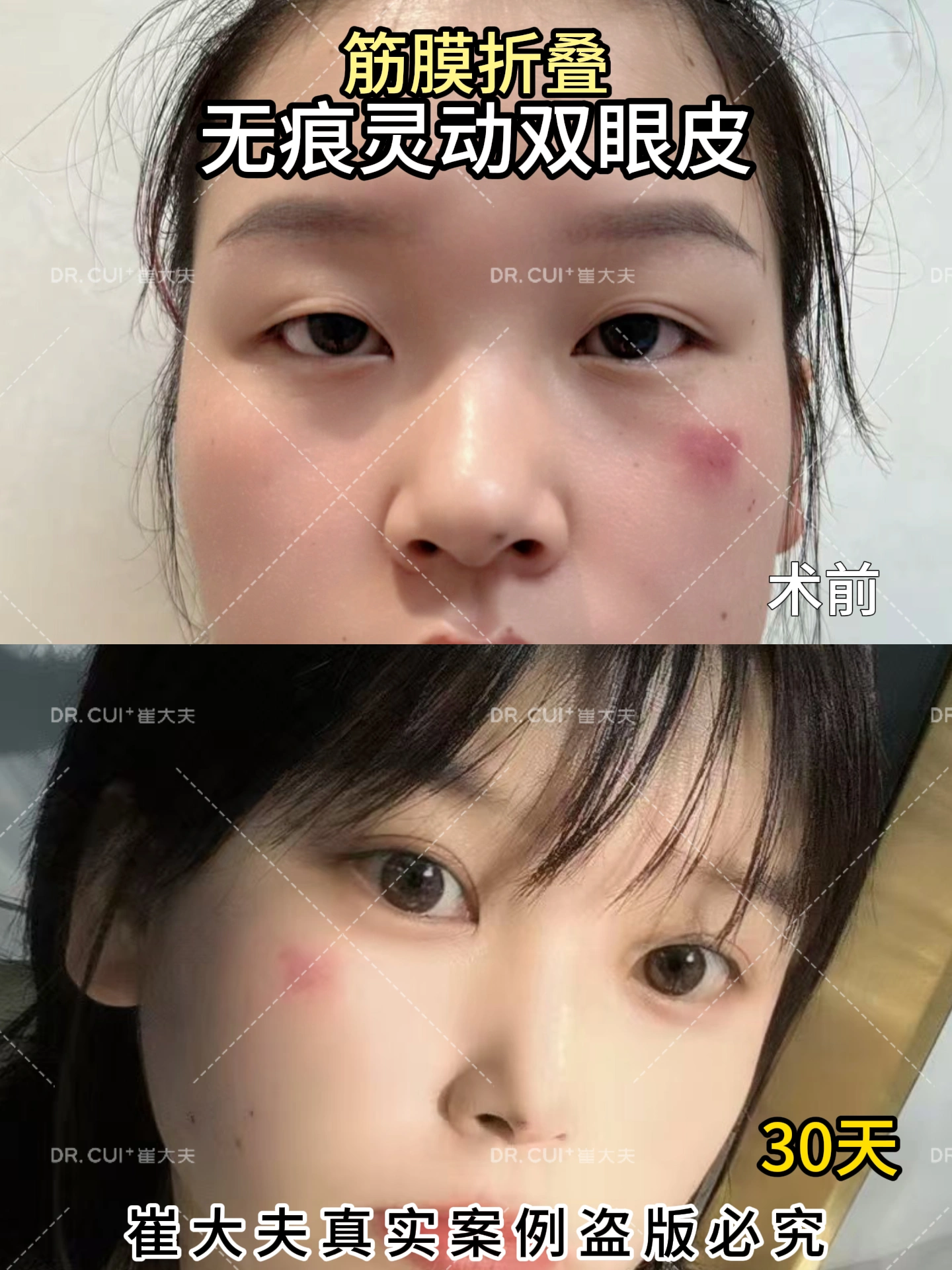 对比 (73)