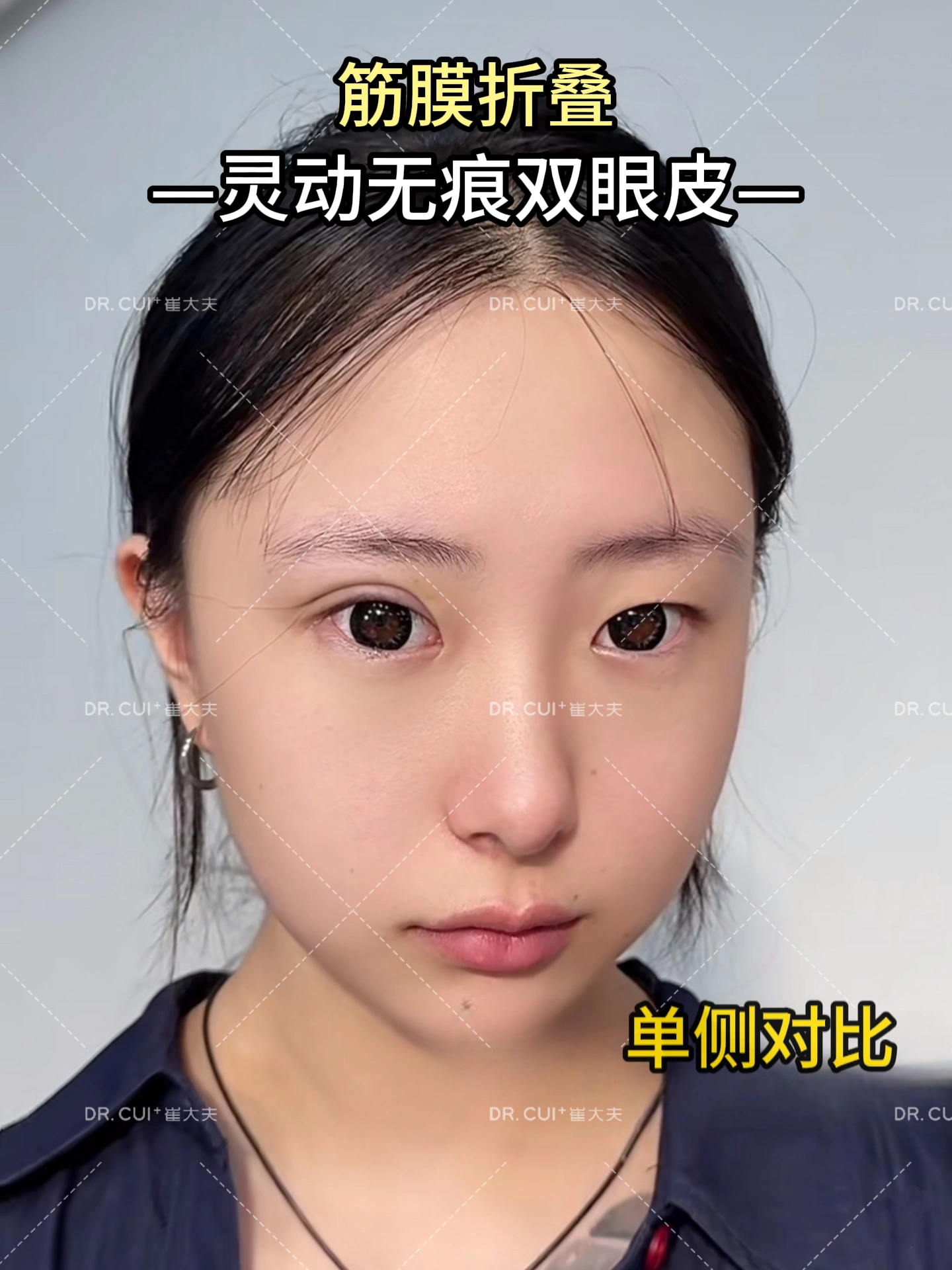 对比 (75)