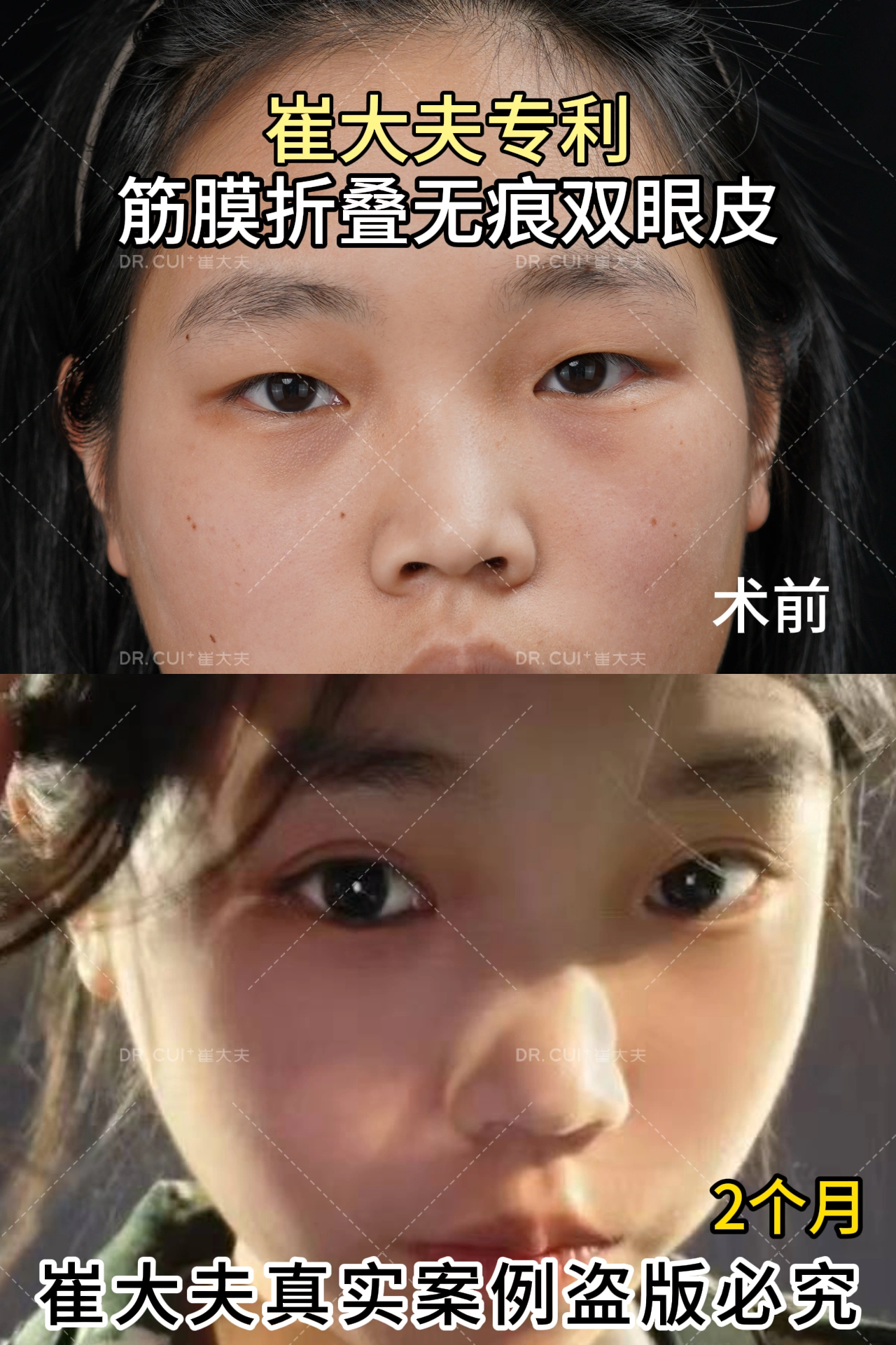 对比 (76)