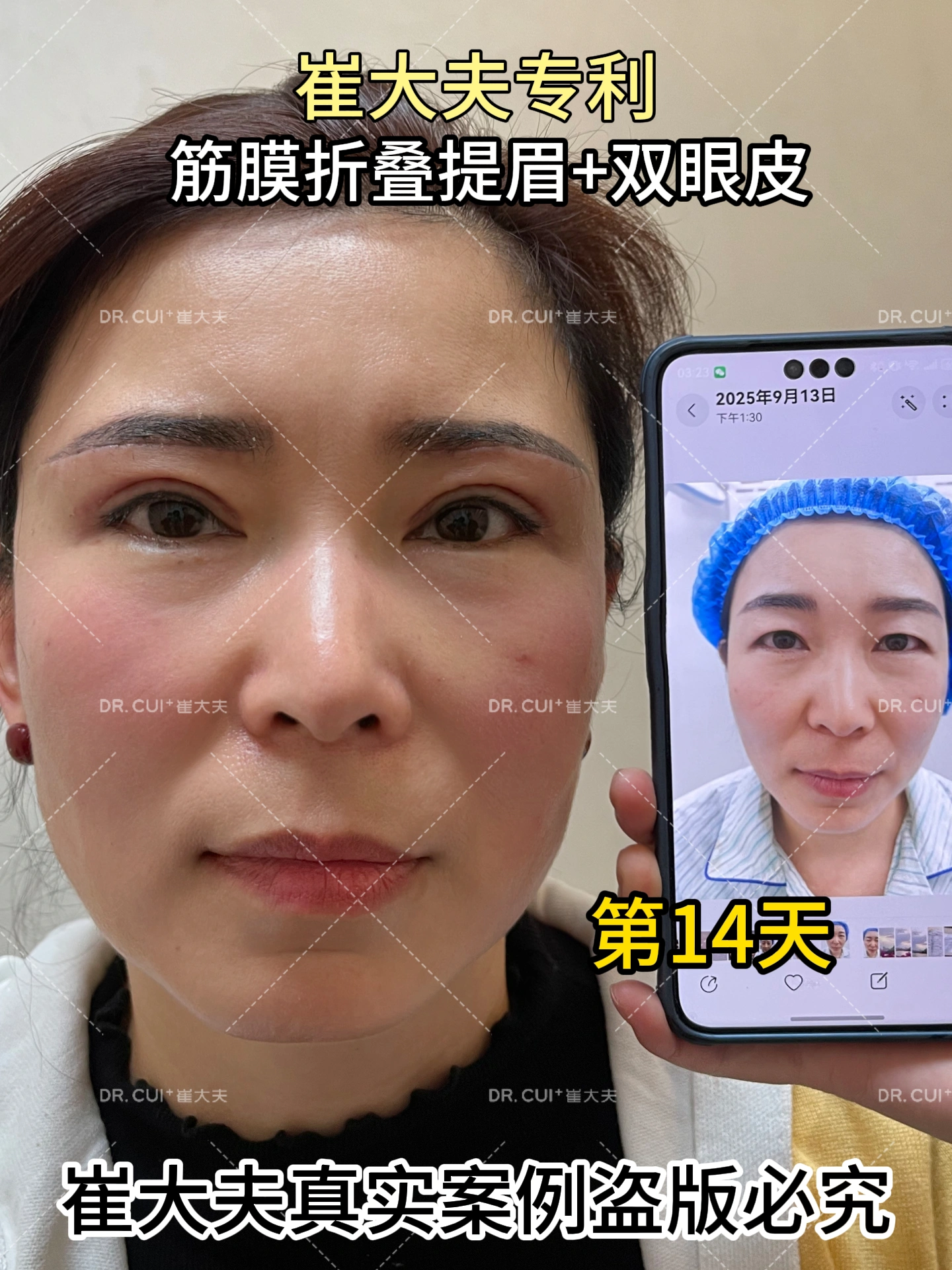 对比 (79)