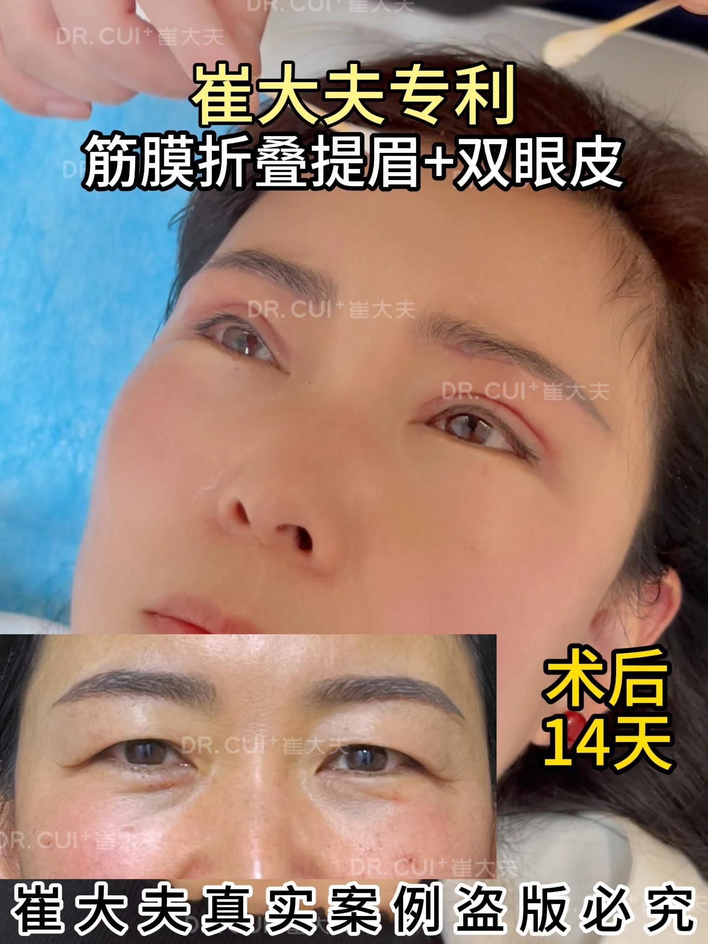 对比 (80)