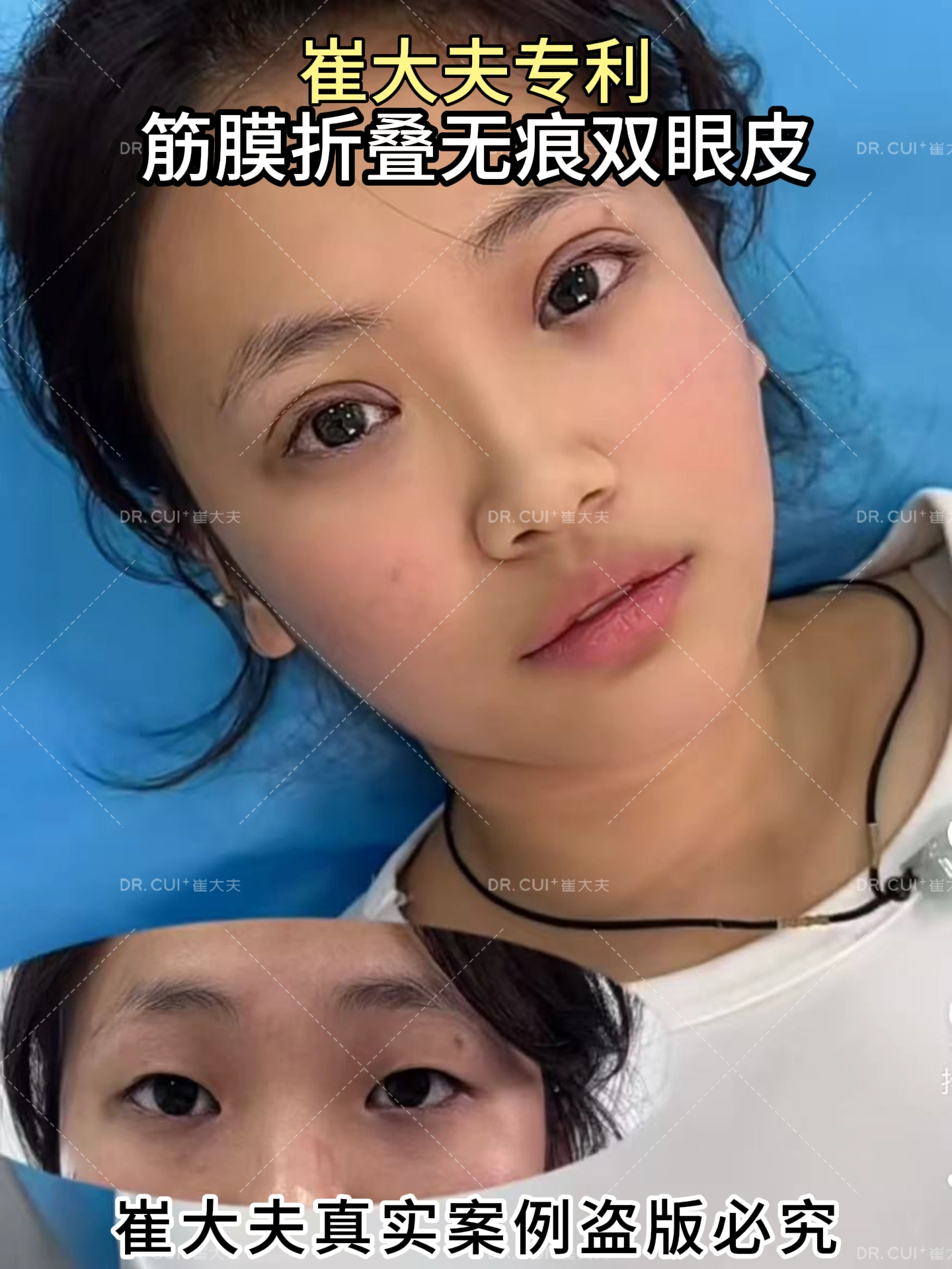 对比 (82)