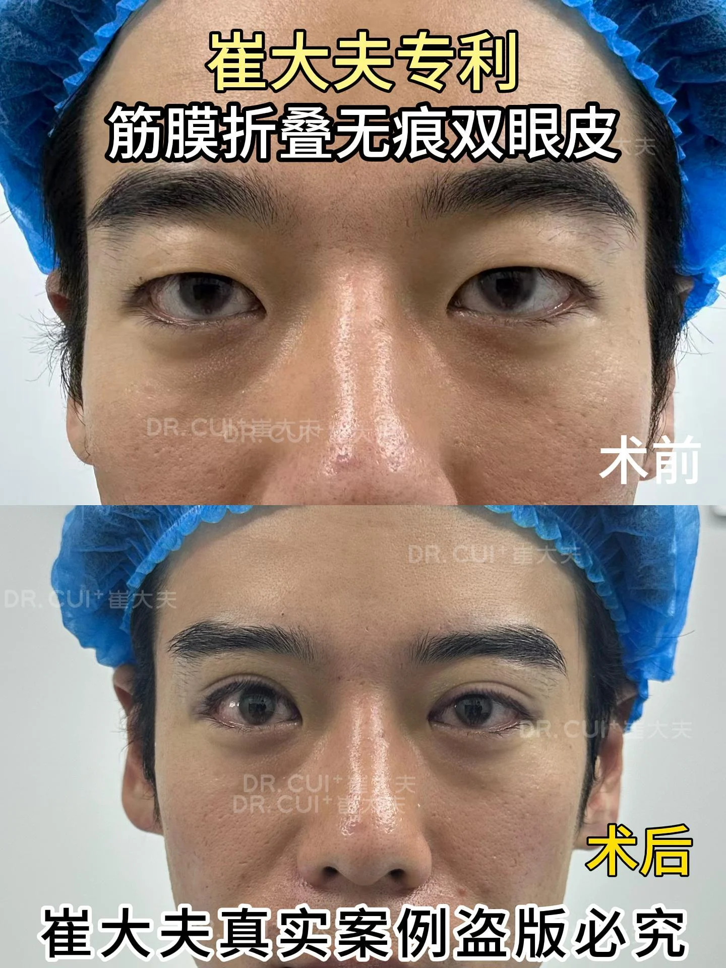 对比 (83)