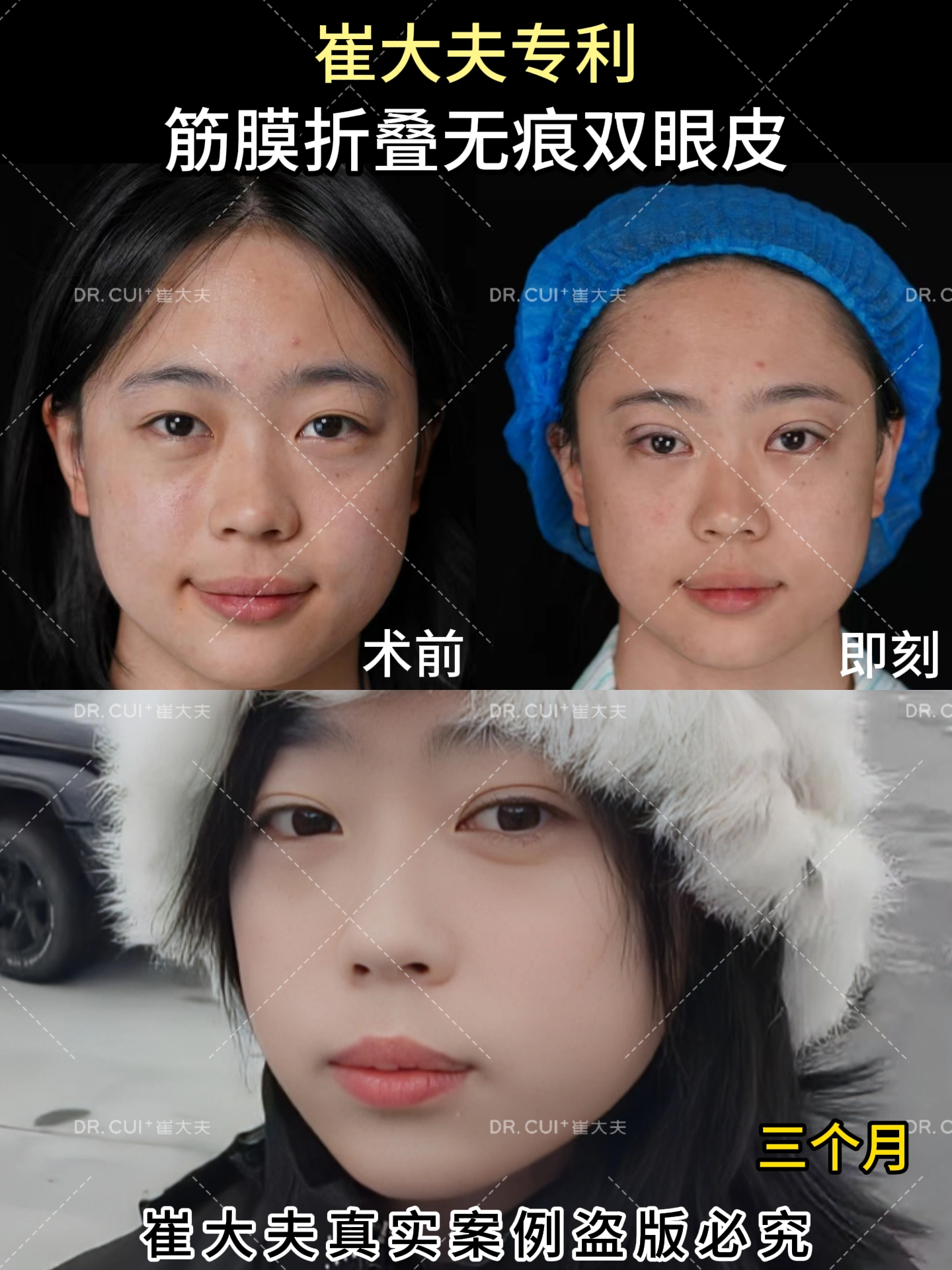 对比 (85)