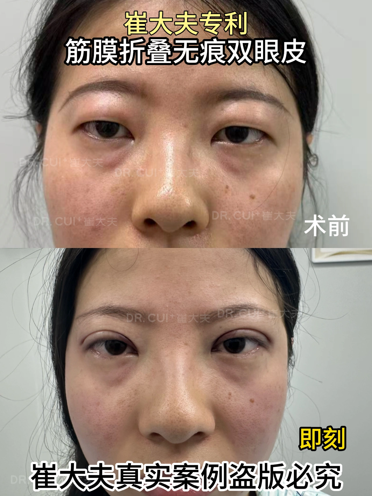 对比 (86)