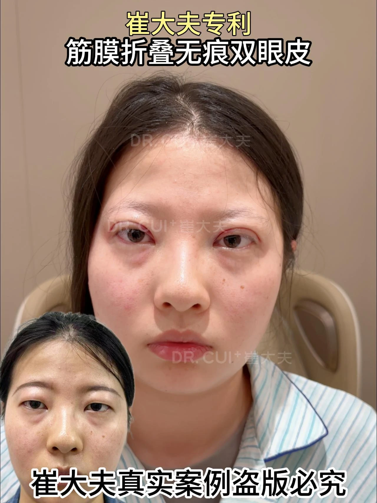 对比 (87)