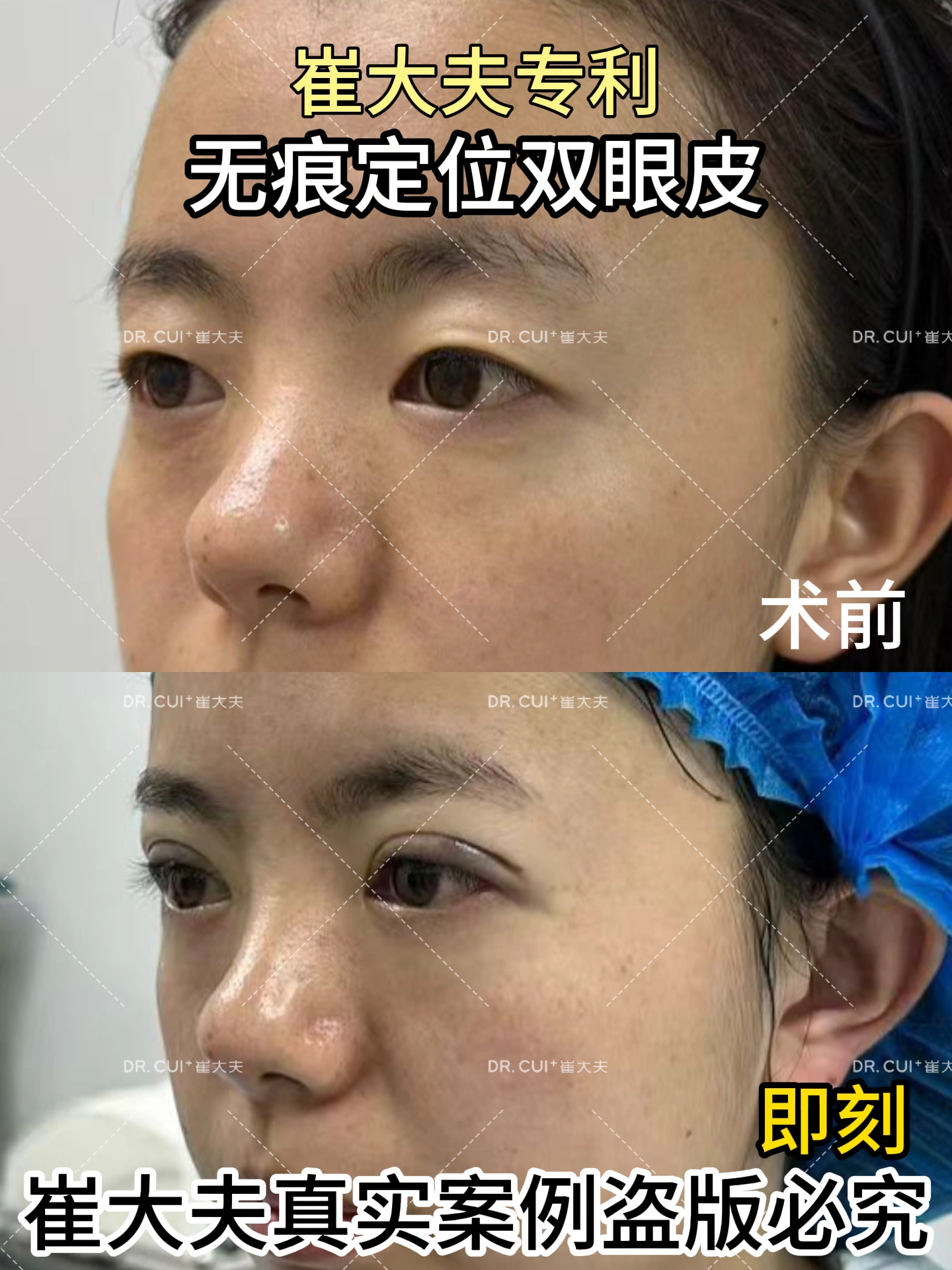 对比 (89)
