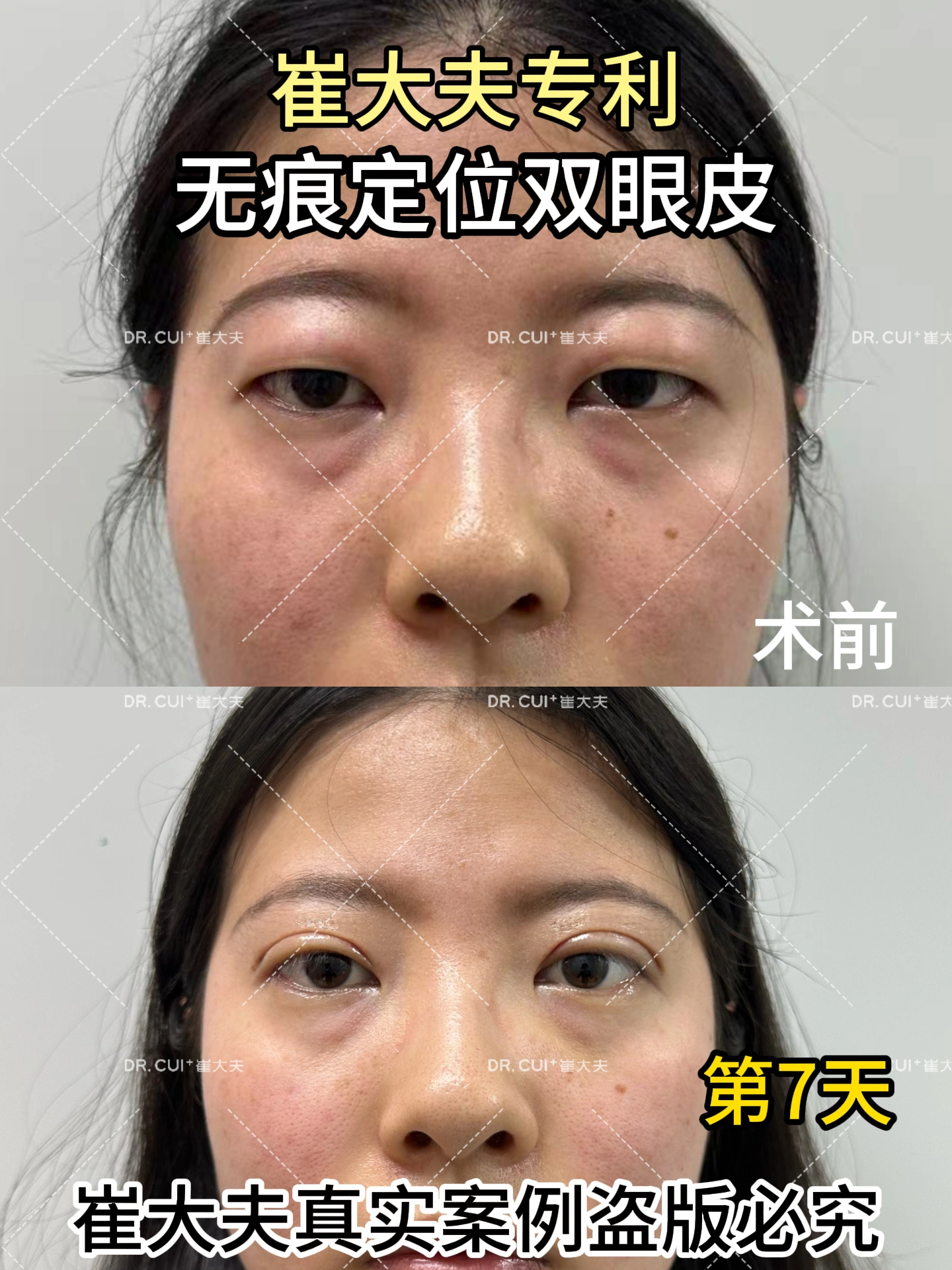 对比 (91)