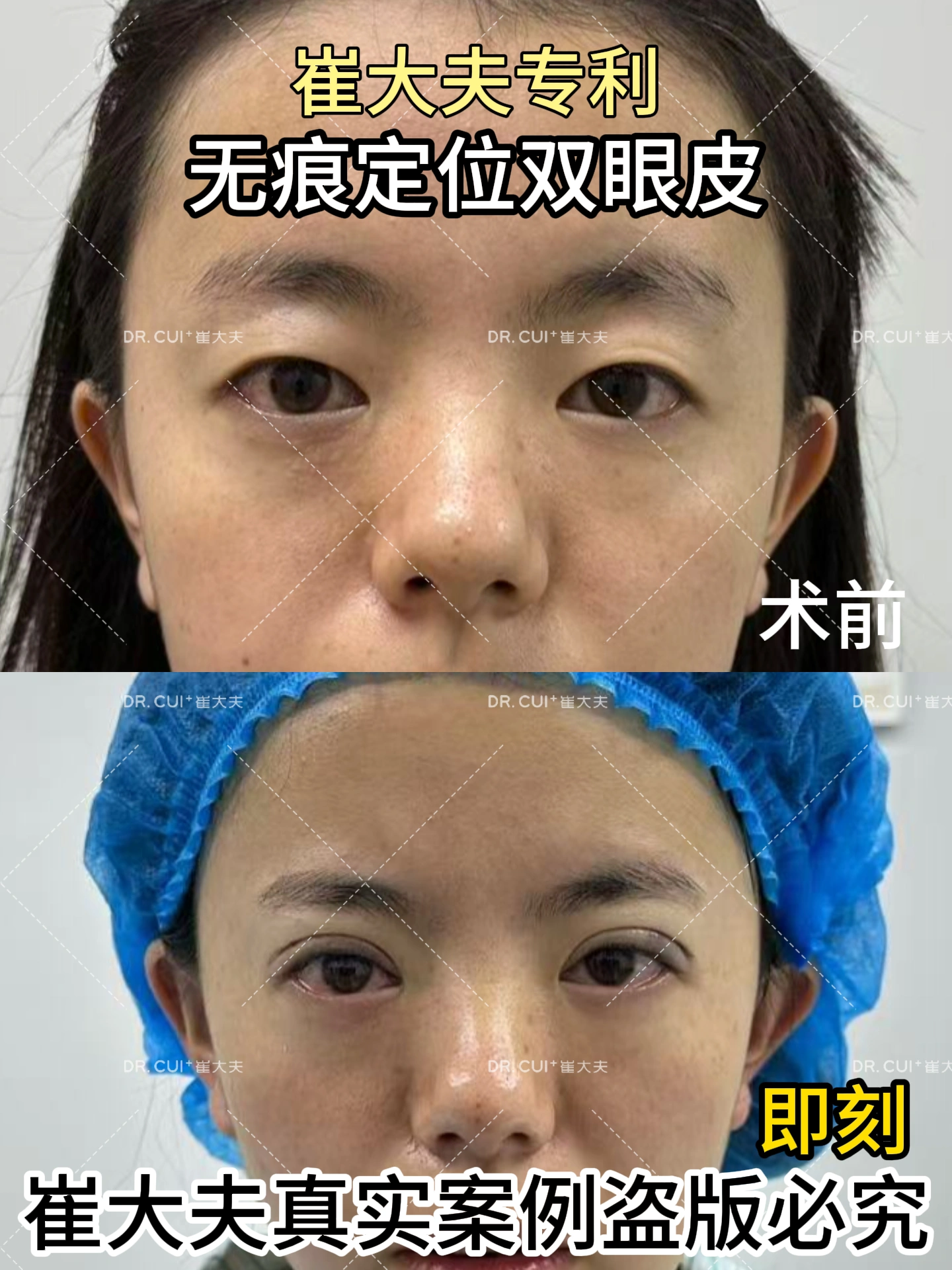对比 (90)