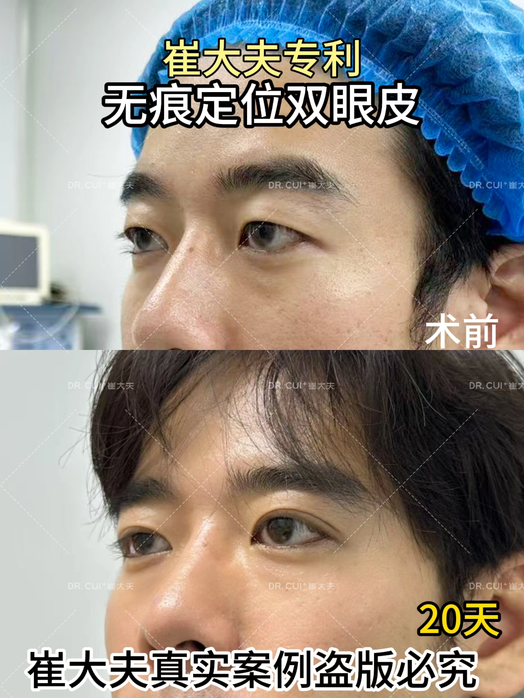 对比 (92)