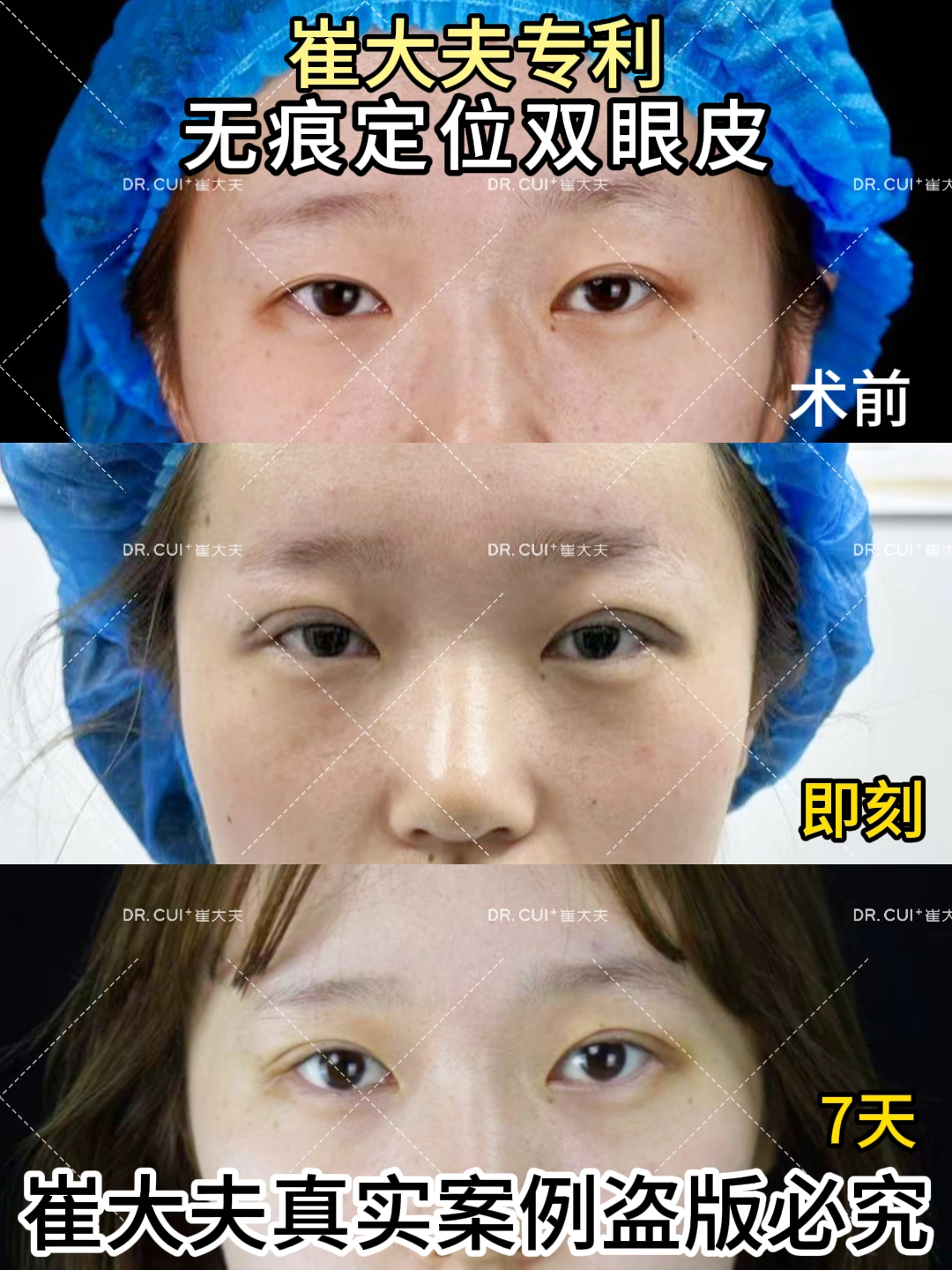 对比 (93)