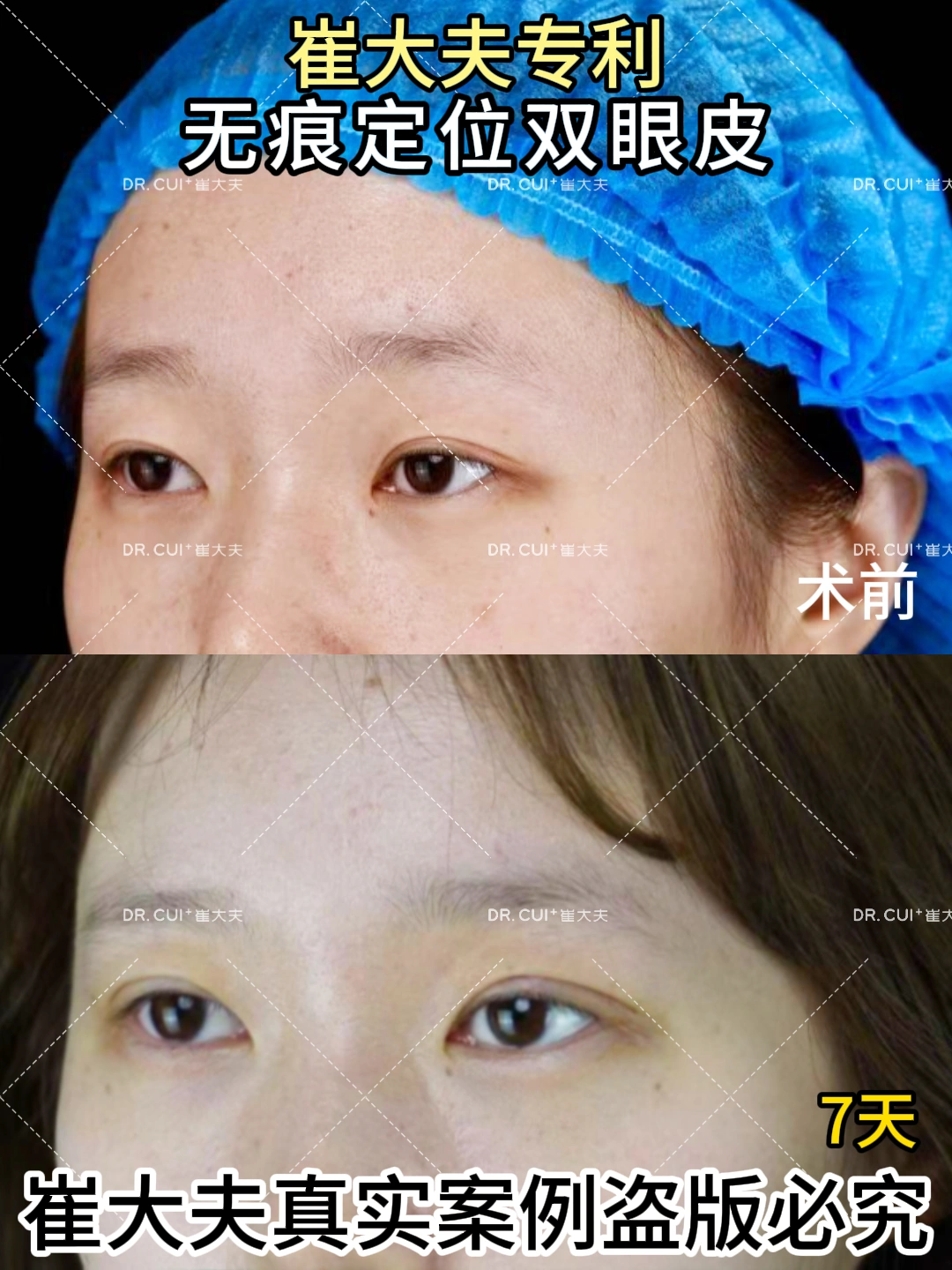 对比 (94)