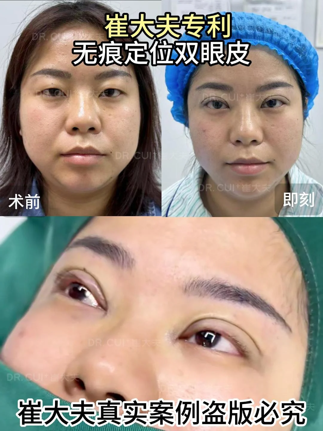 对比 (95)