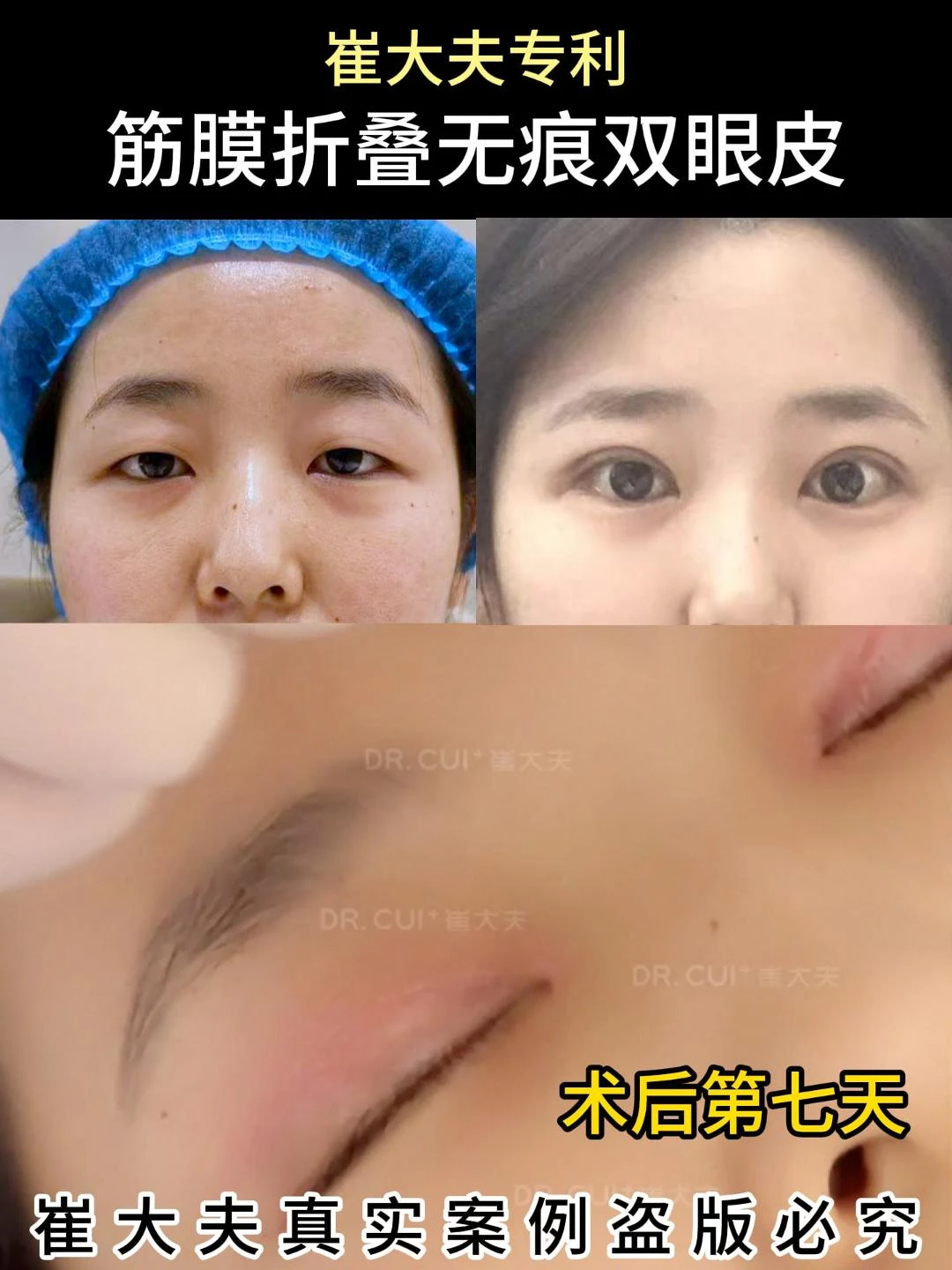 对比 (96)