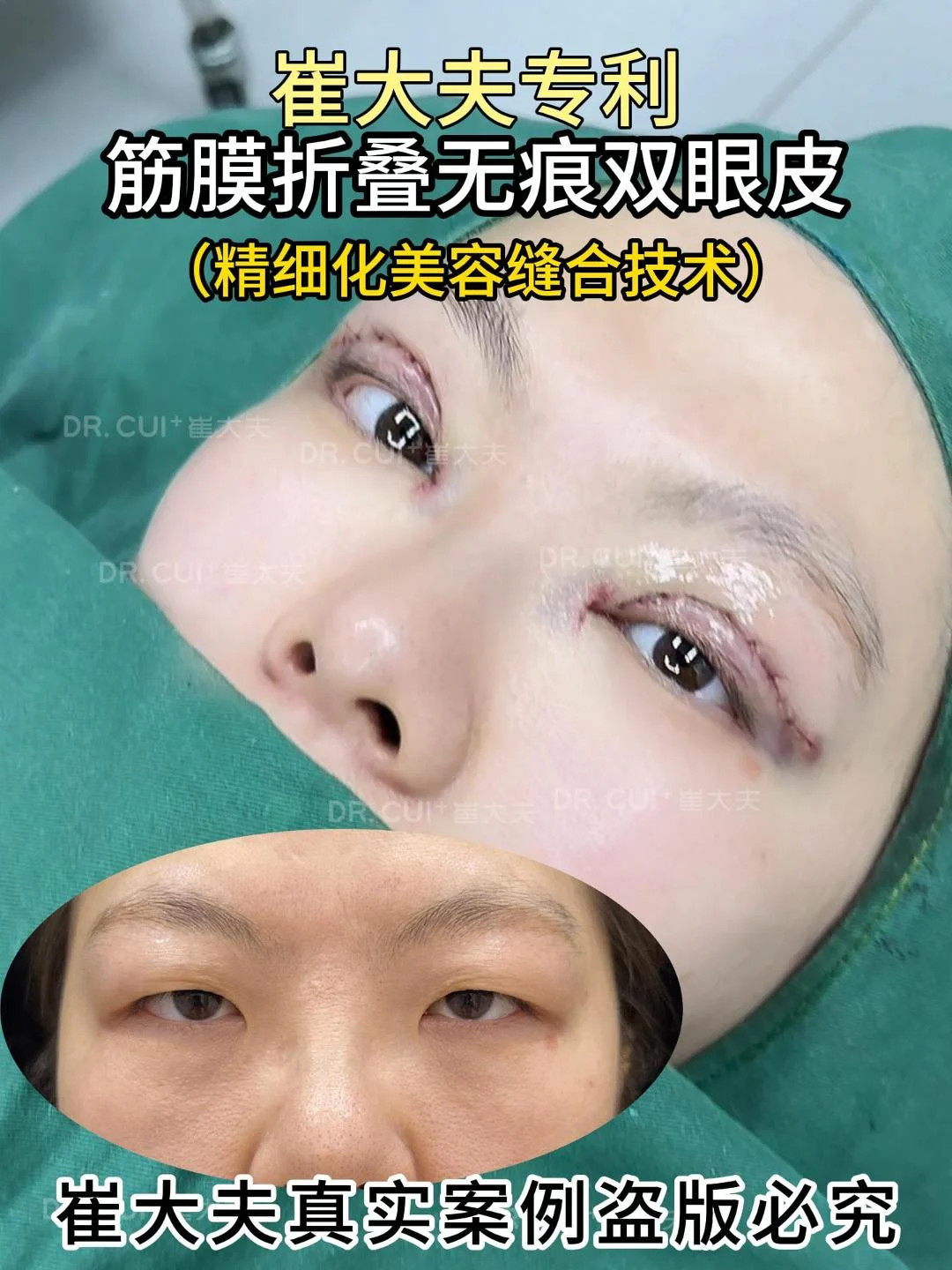 对比 (97)