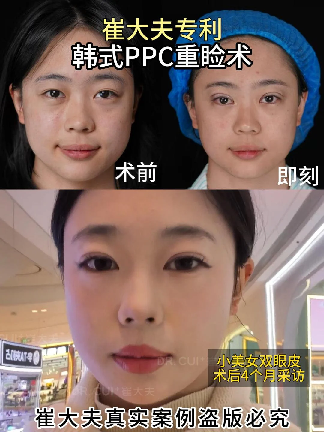 对比 (98)