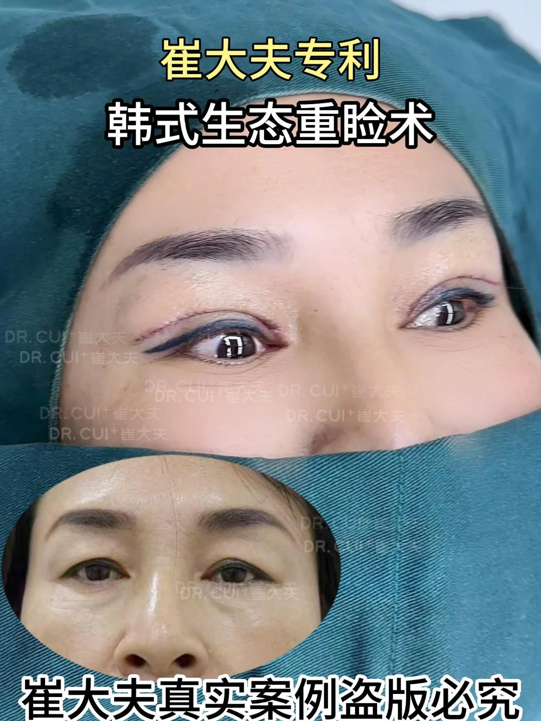 对比 (99)