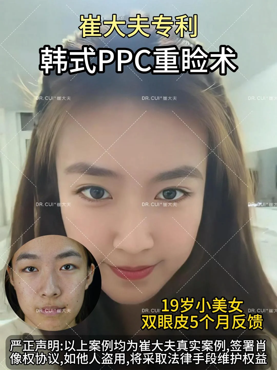 对比 (100)