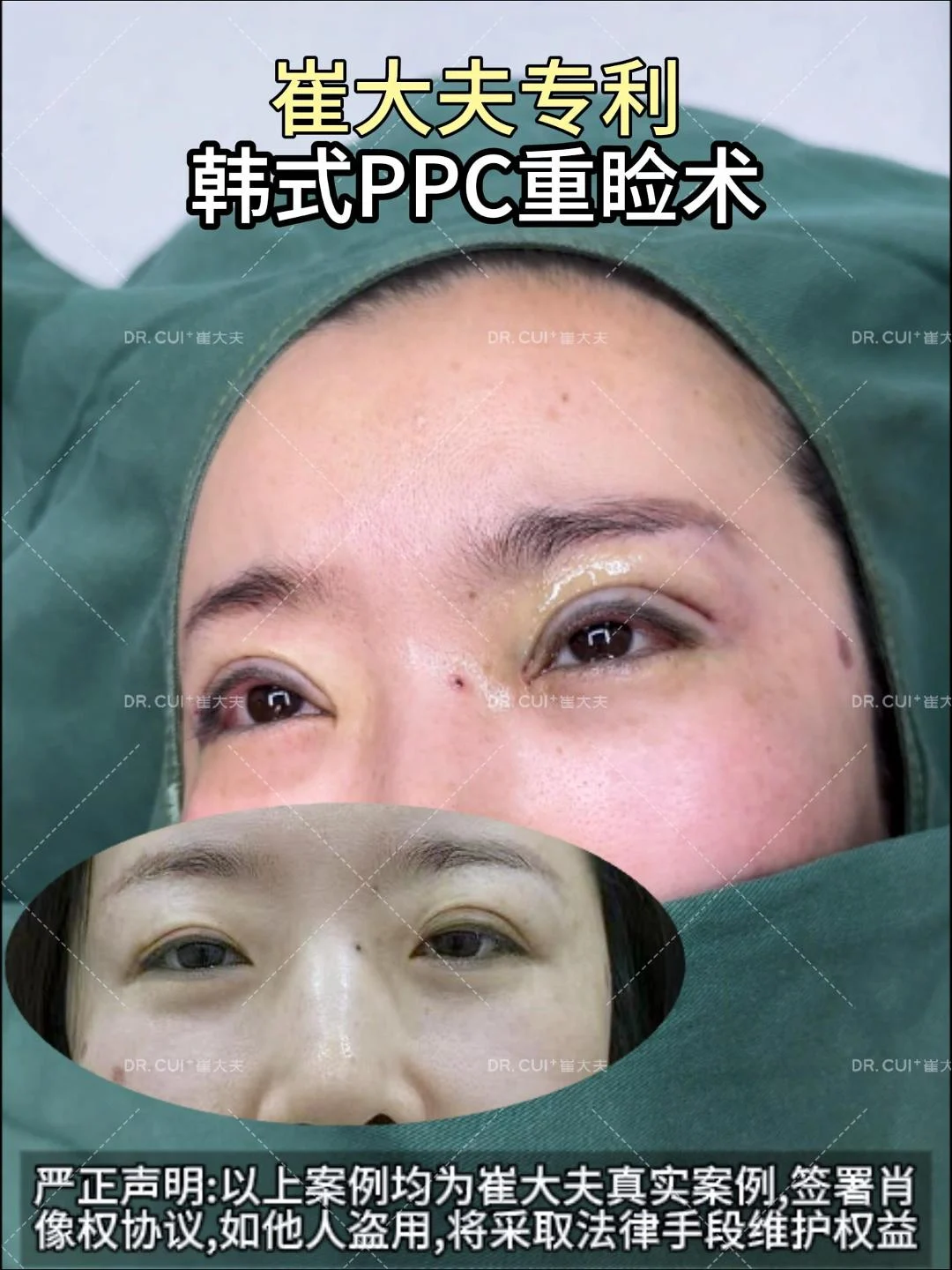 对比 (101)