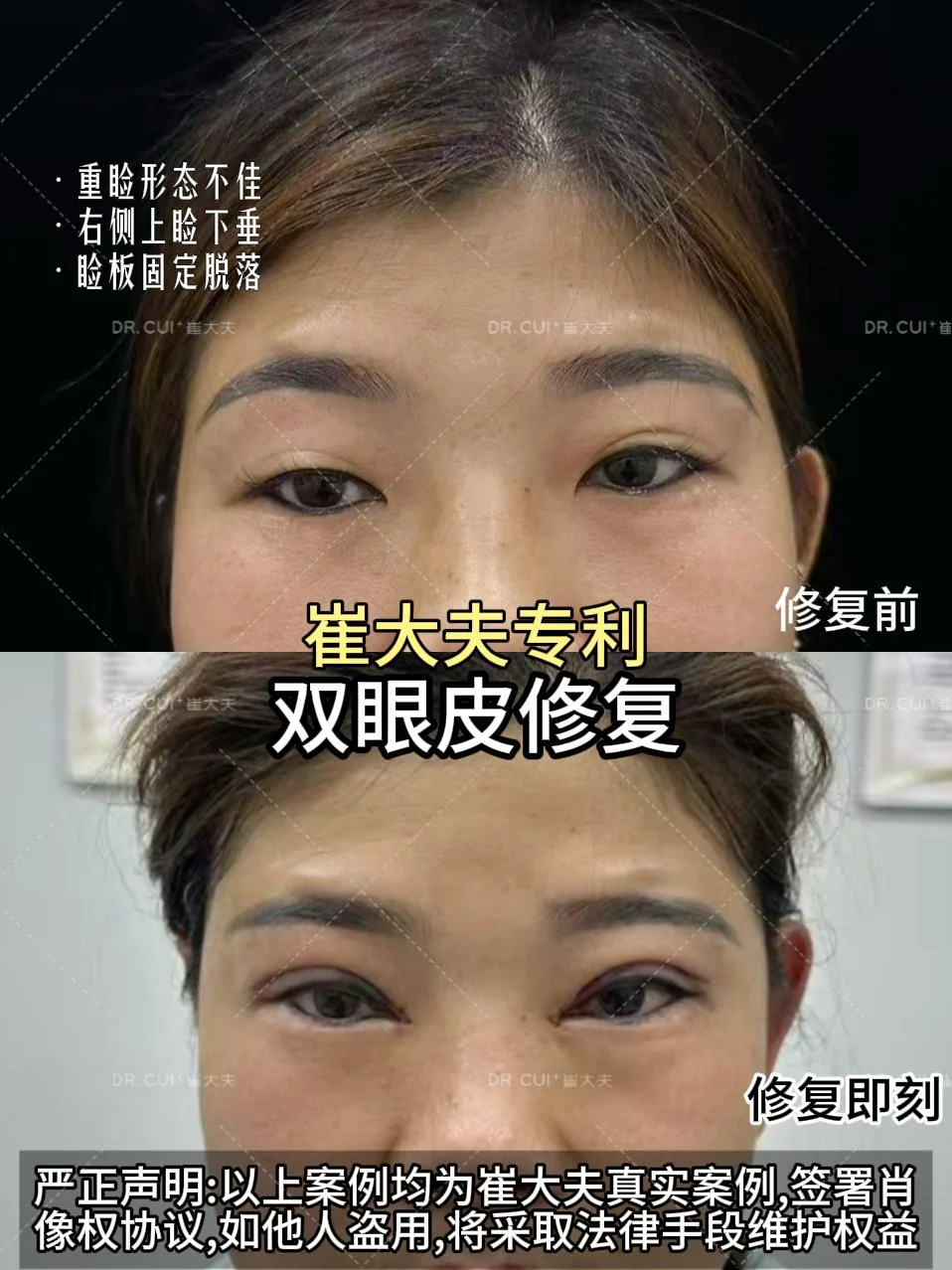 对比 (102)