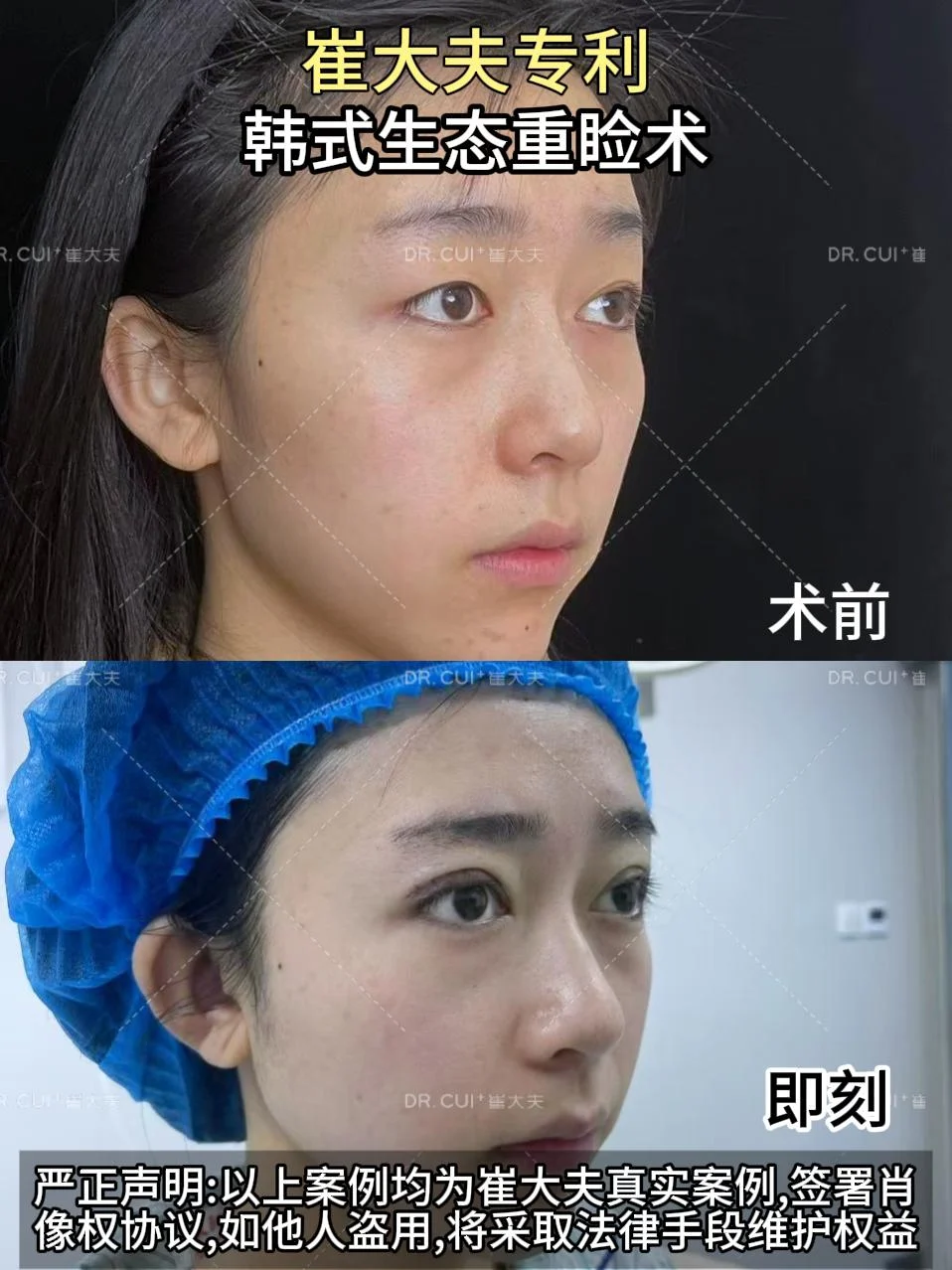 对比 (103)