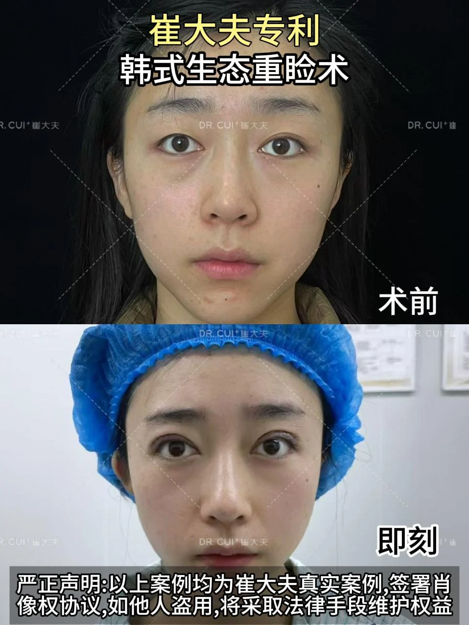对比 (104)