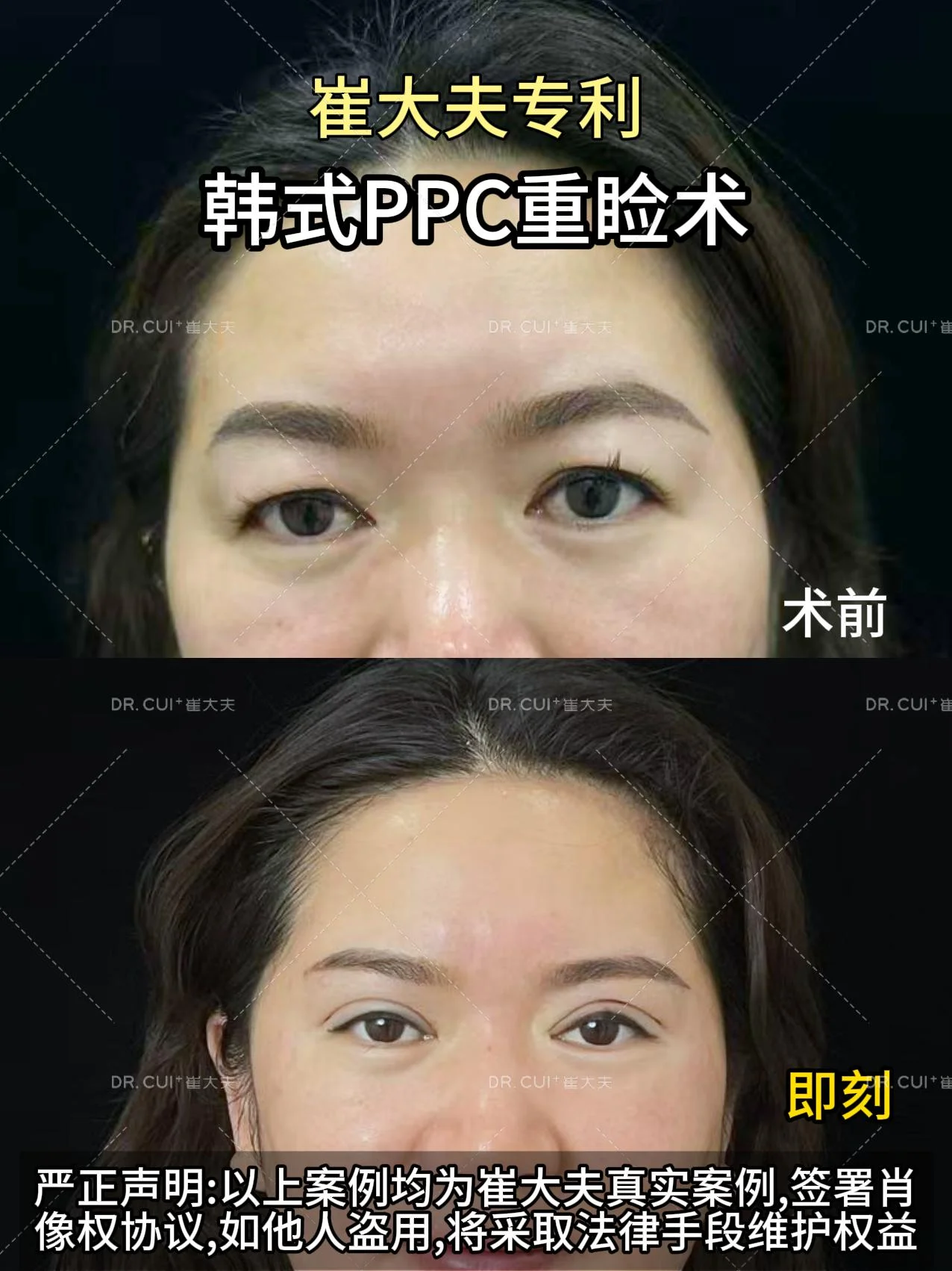 对比 (105)