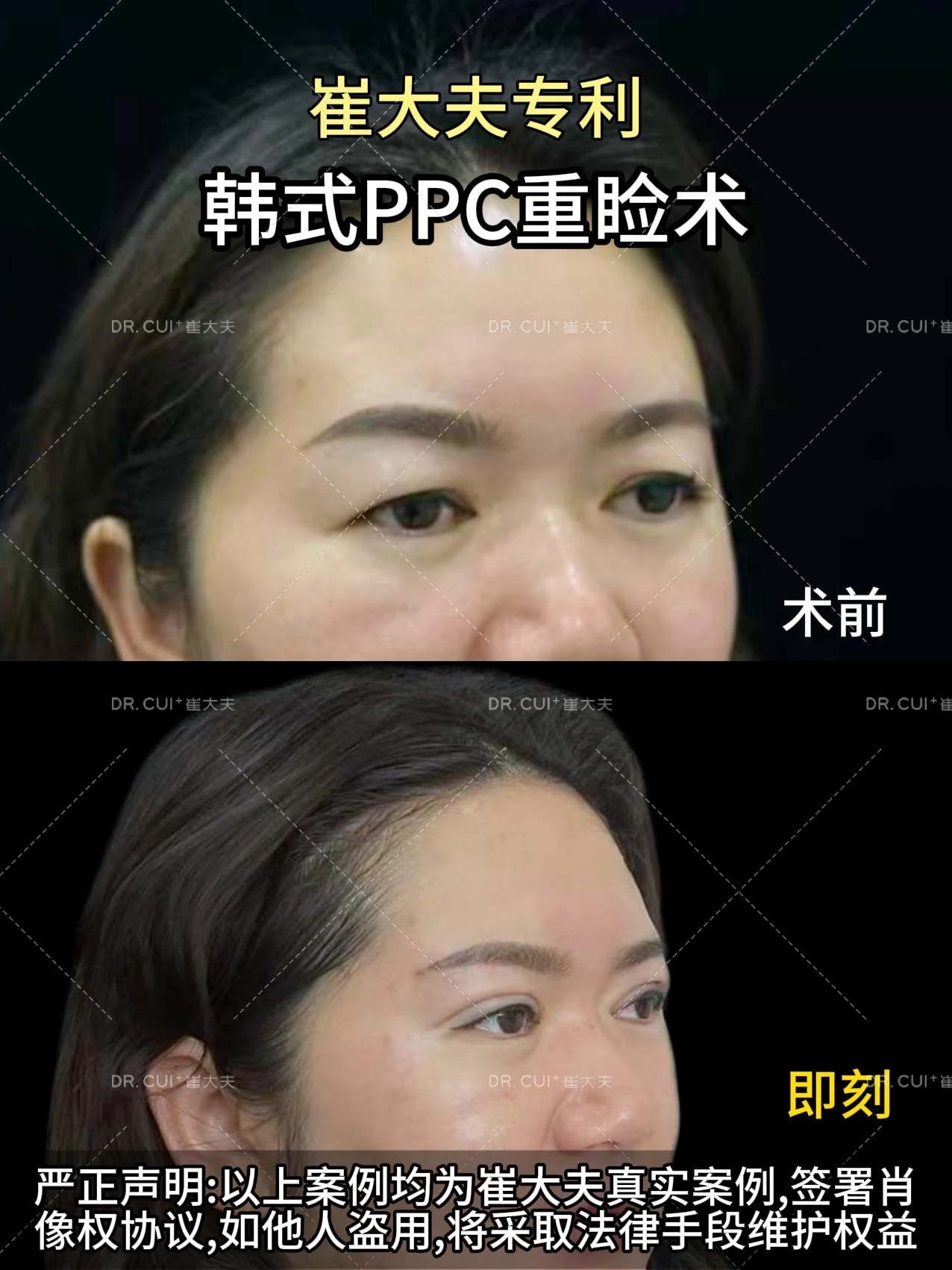 对比 (106)
