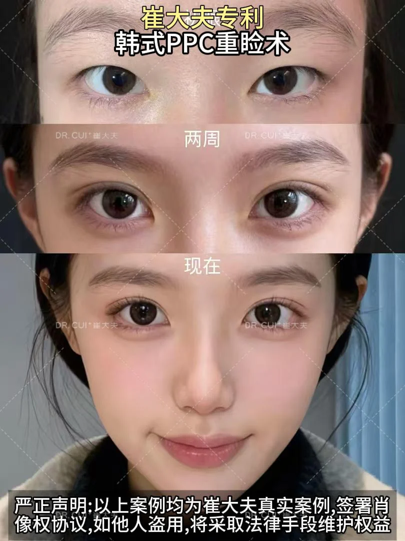 对比 (108)