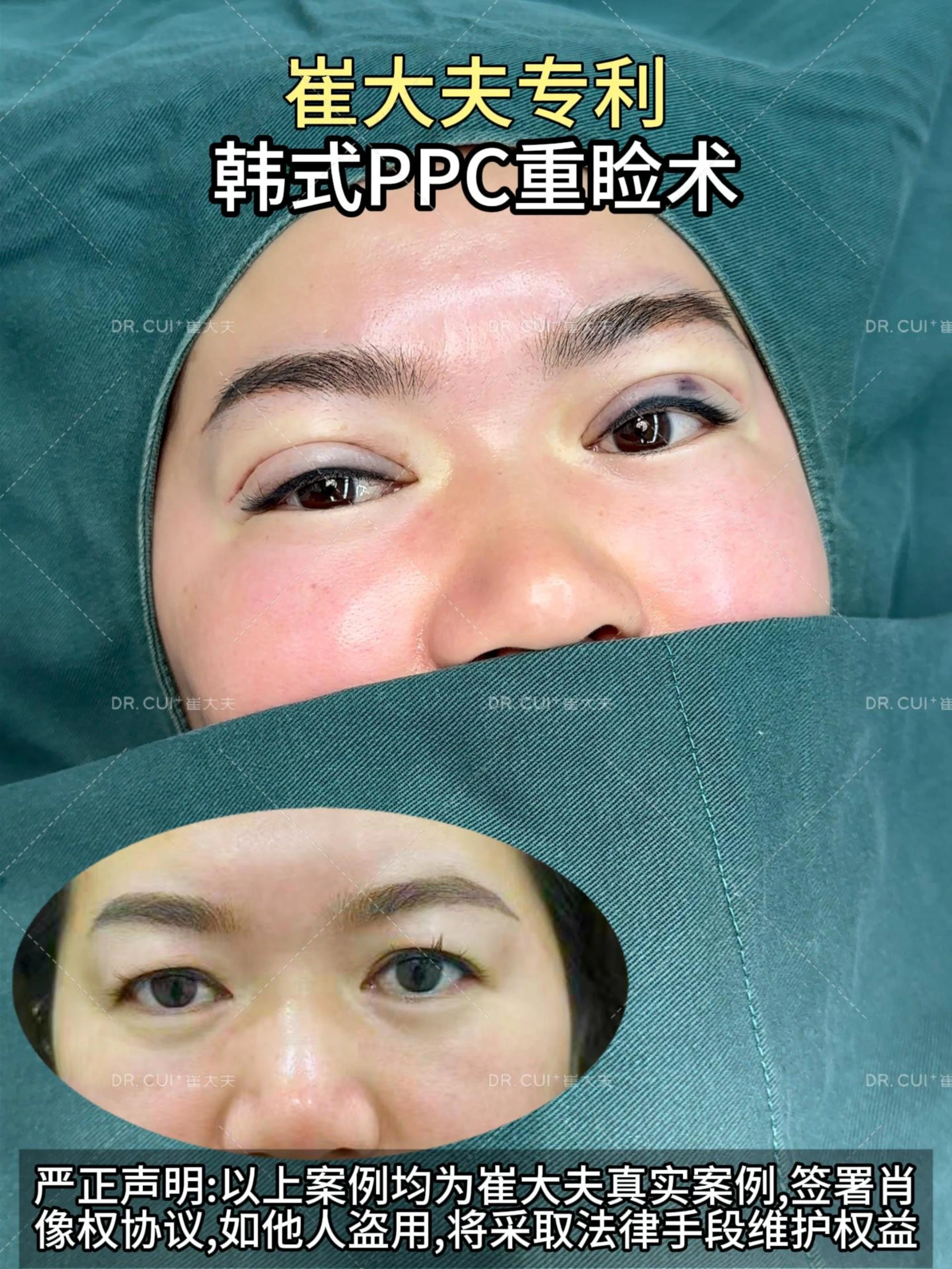 对比 (107)