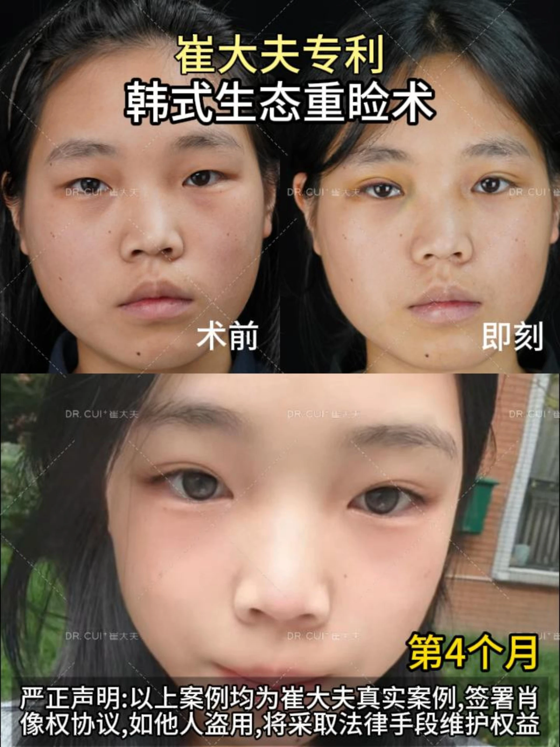 对比 (110)